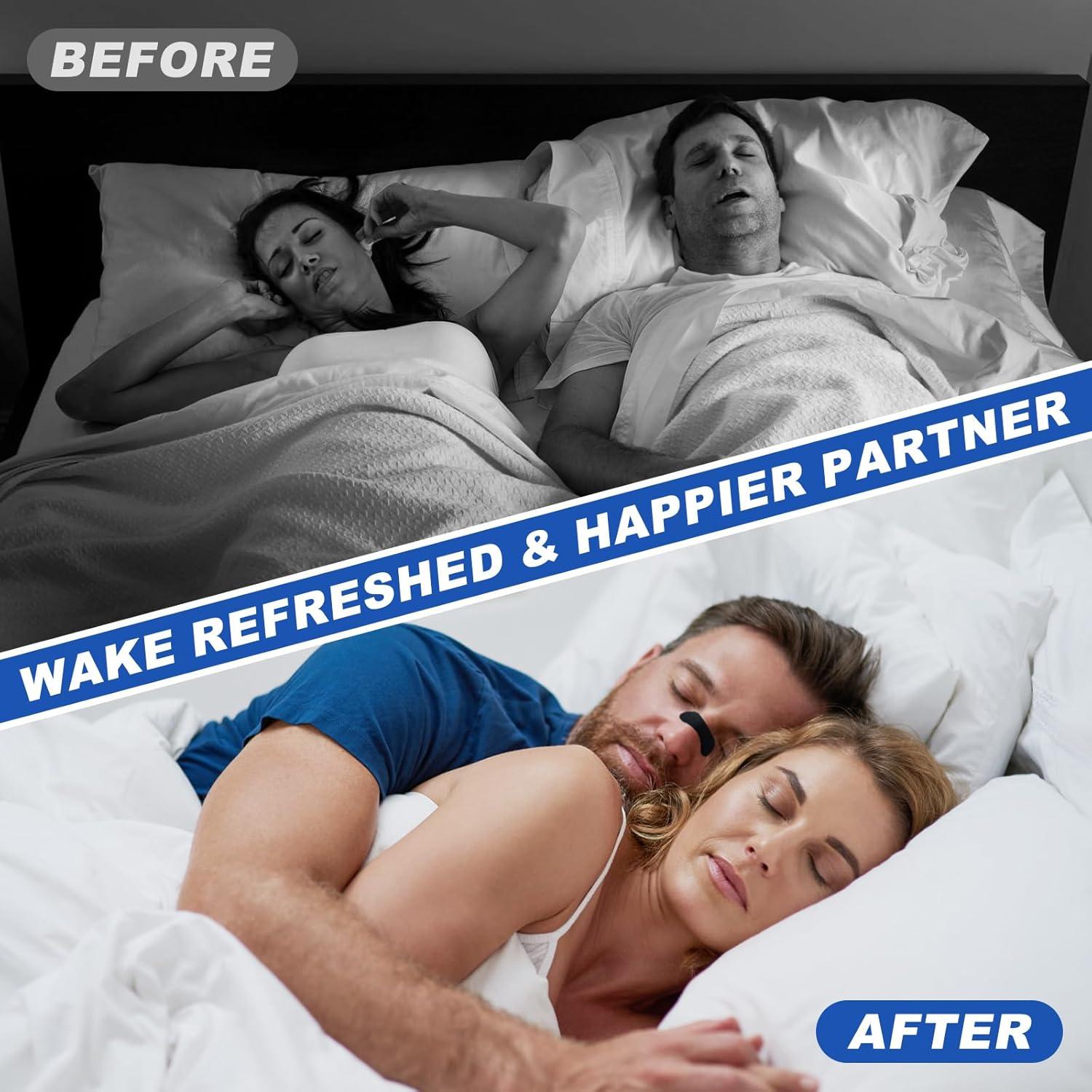 Tiras Nasales Ventro Vykor para Ronquidos - 60 Unidades, Negro