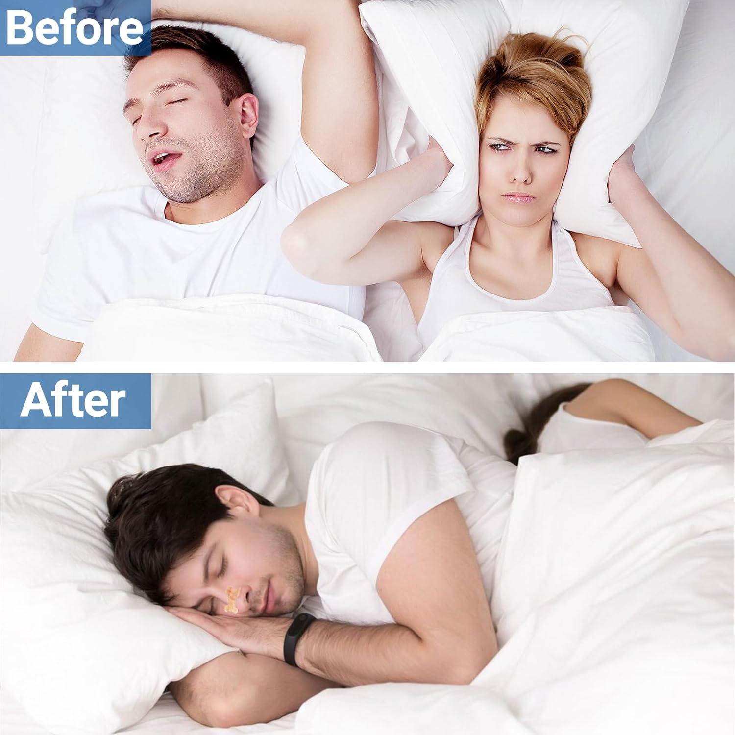 Tiras Nasales iShanCare 30 Conteo para Mejor Sueño y Respiración