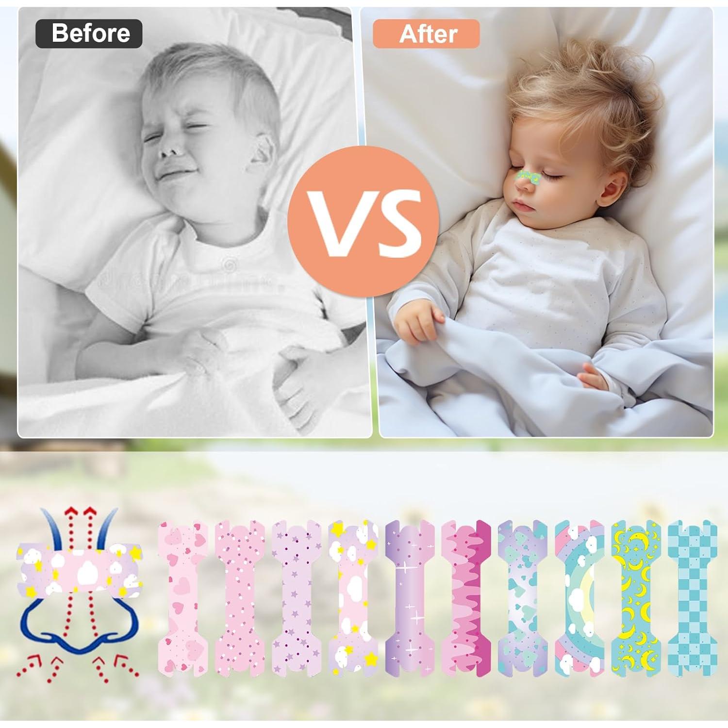 30 Tiras Nasales para Niños Aartner Rosa y Azul Antironquidos