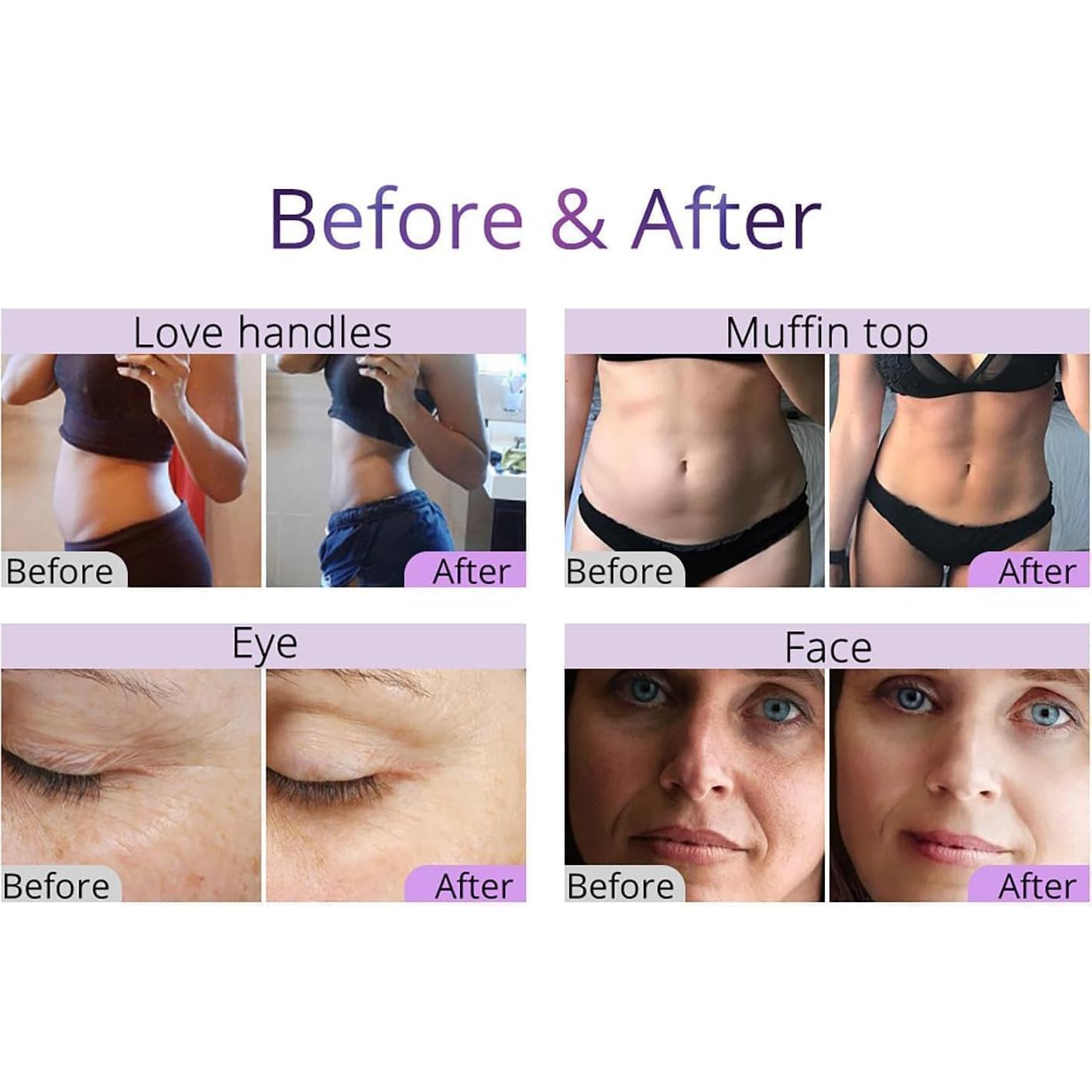 Masajeador Corporal Multifuncional 9 en 1 GSCOM 2025