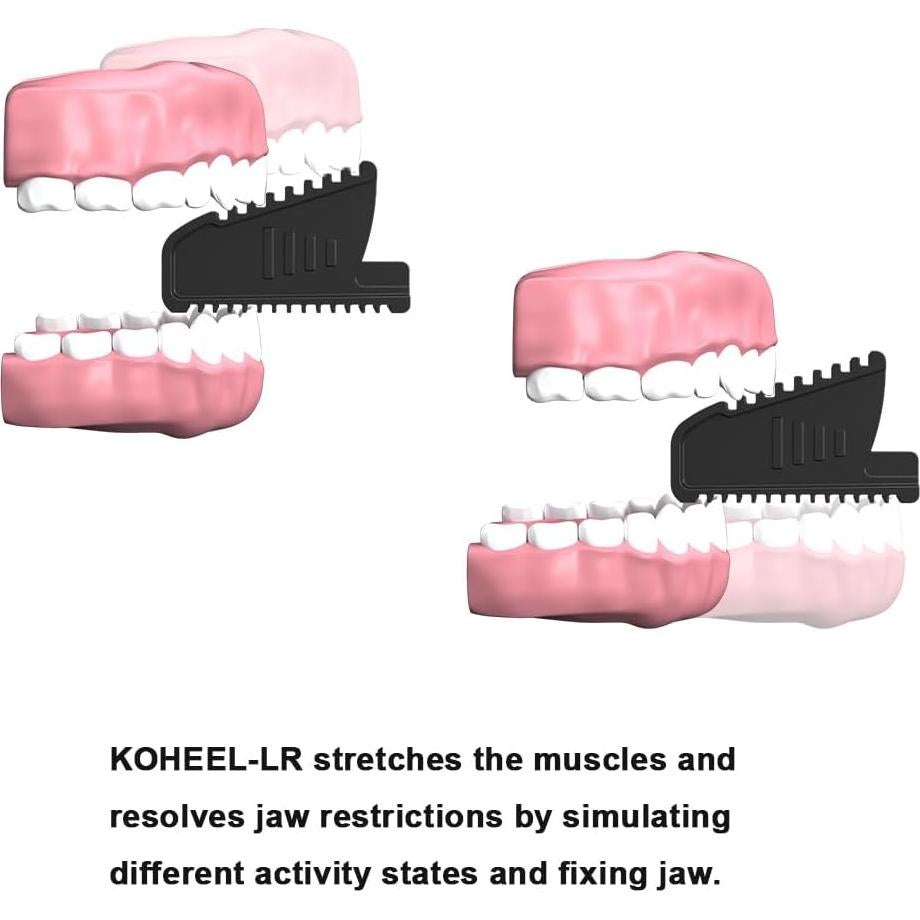 Dispositivo de Alivio de Mandíbula KOHEEL LR para TMJ y Bruxismo