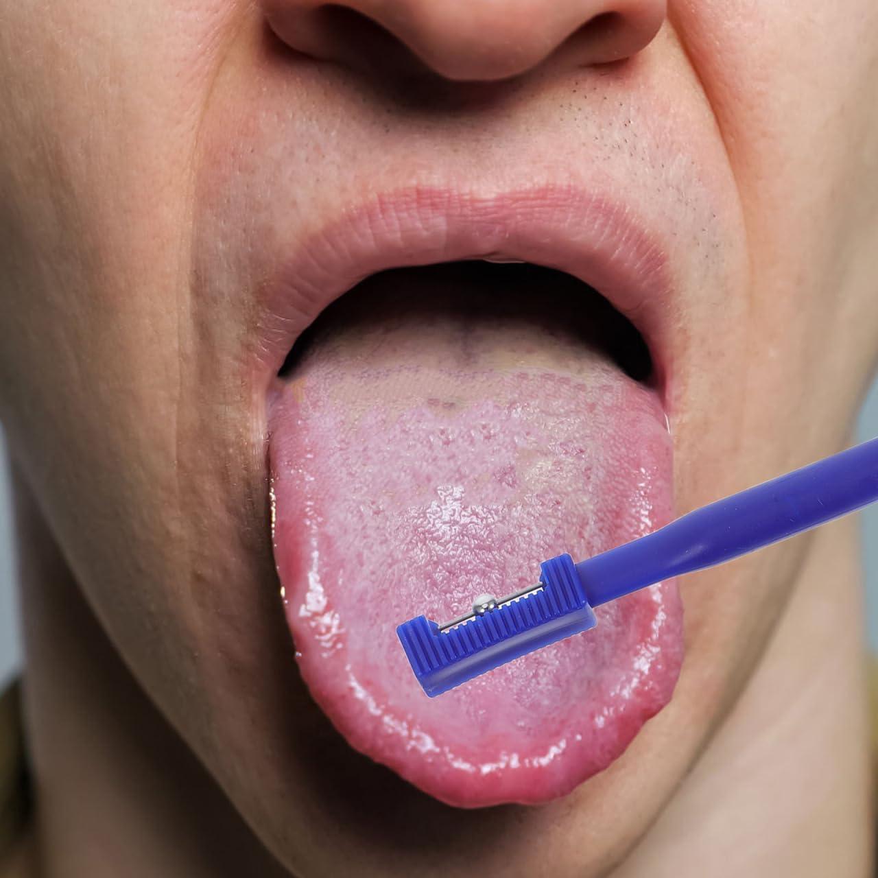 Entrenador Muscular Oral Didiseaon para Niños - Terapia del Habla