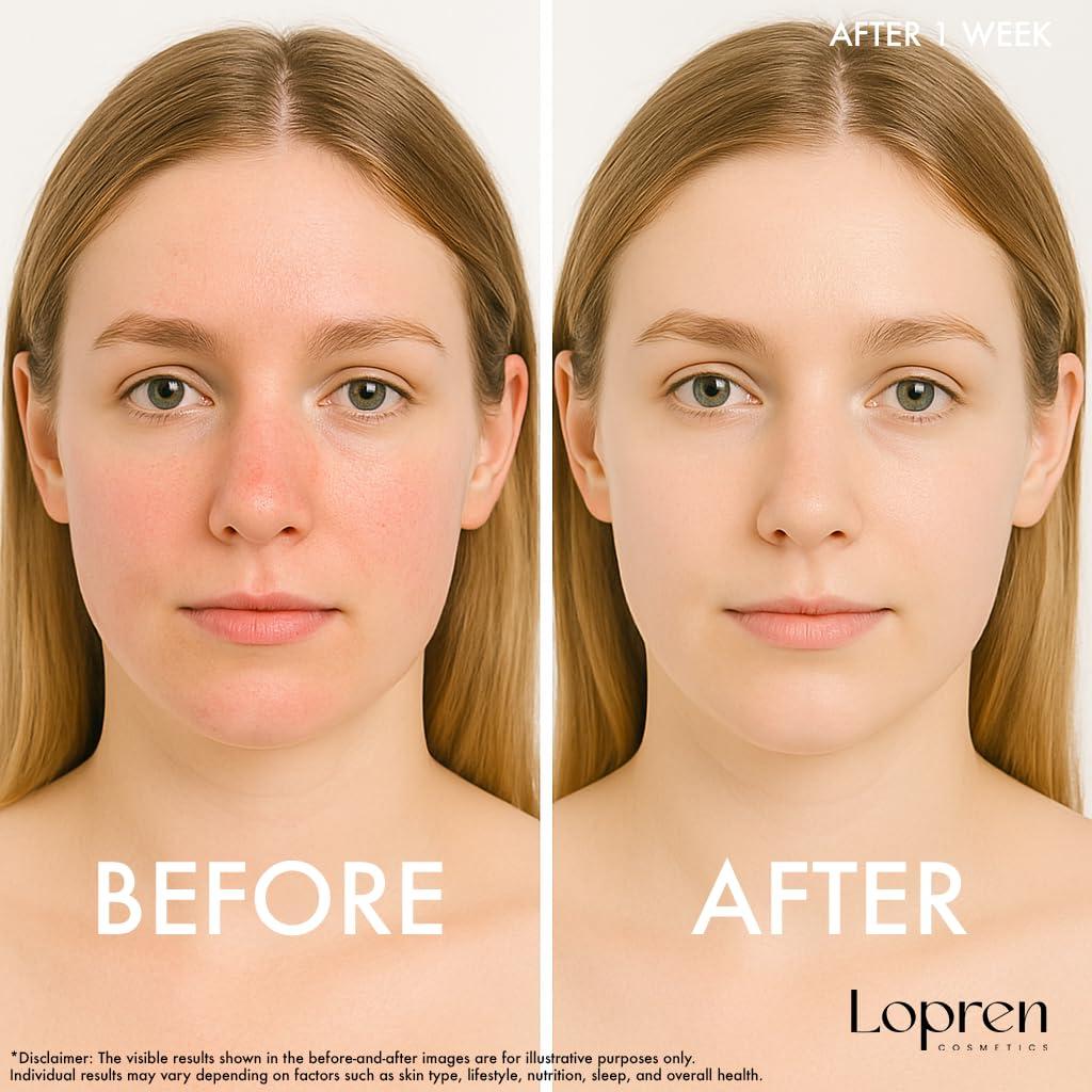 Gel Limpiador Facial Lopren 399.5 ml Piel Sensible Aloe Manzanilla