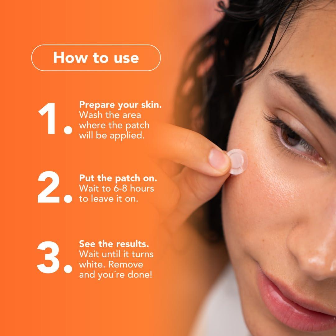 Parches para Granitos Alux - 30 Unidades Hidrocoloide Piel Sensible