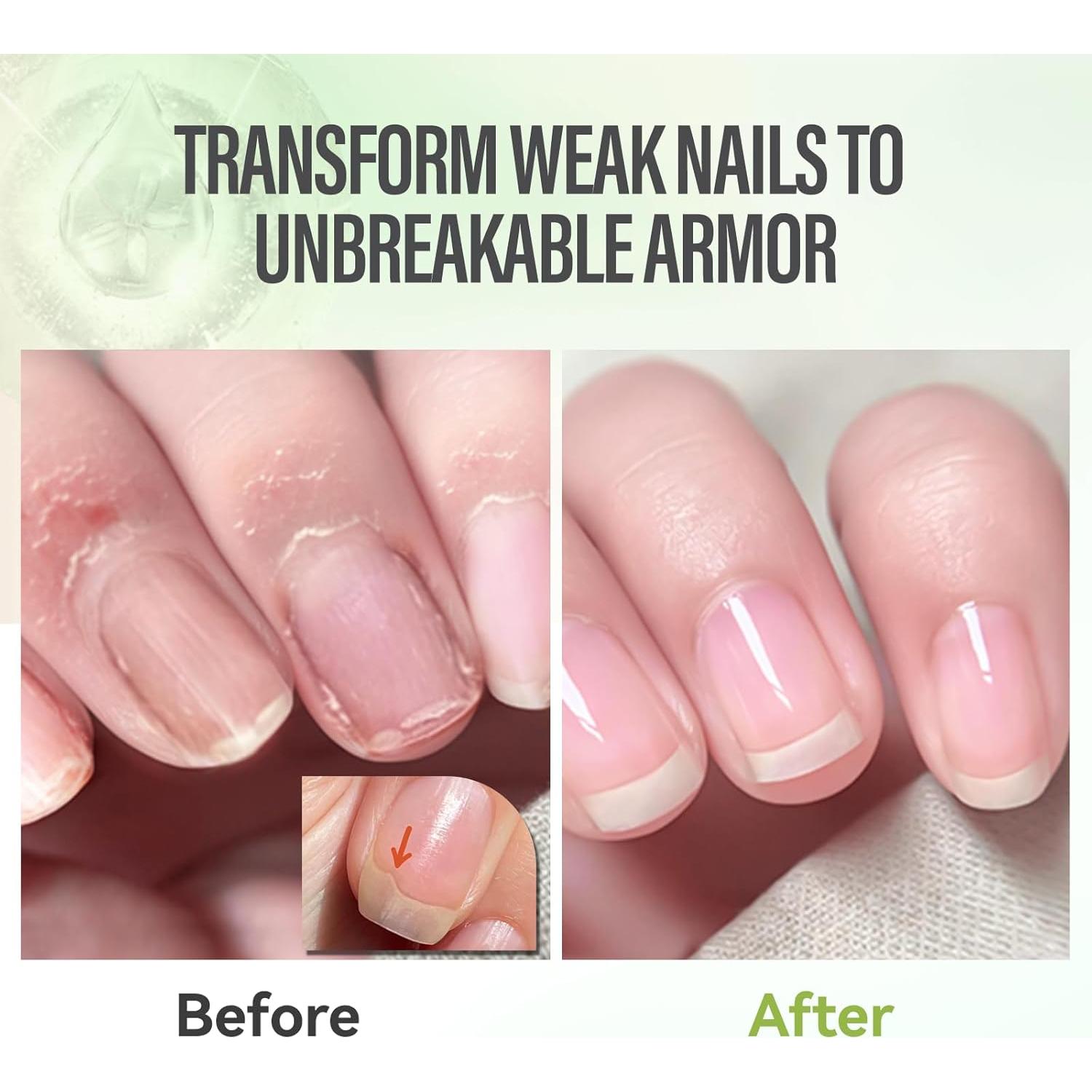 Aceite para Uñas CHUCHU con Jojoba y Aloe Vera 59g