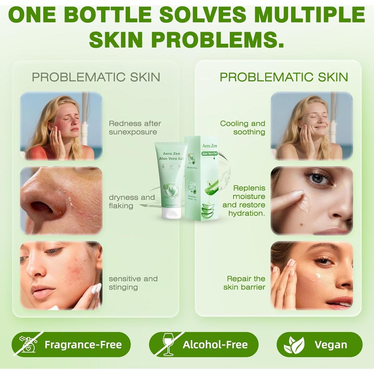 Gel de Aloe Vera 98% Aero Zen 154 ml Hidratante Natural