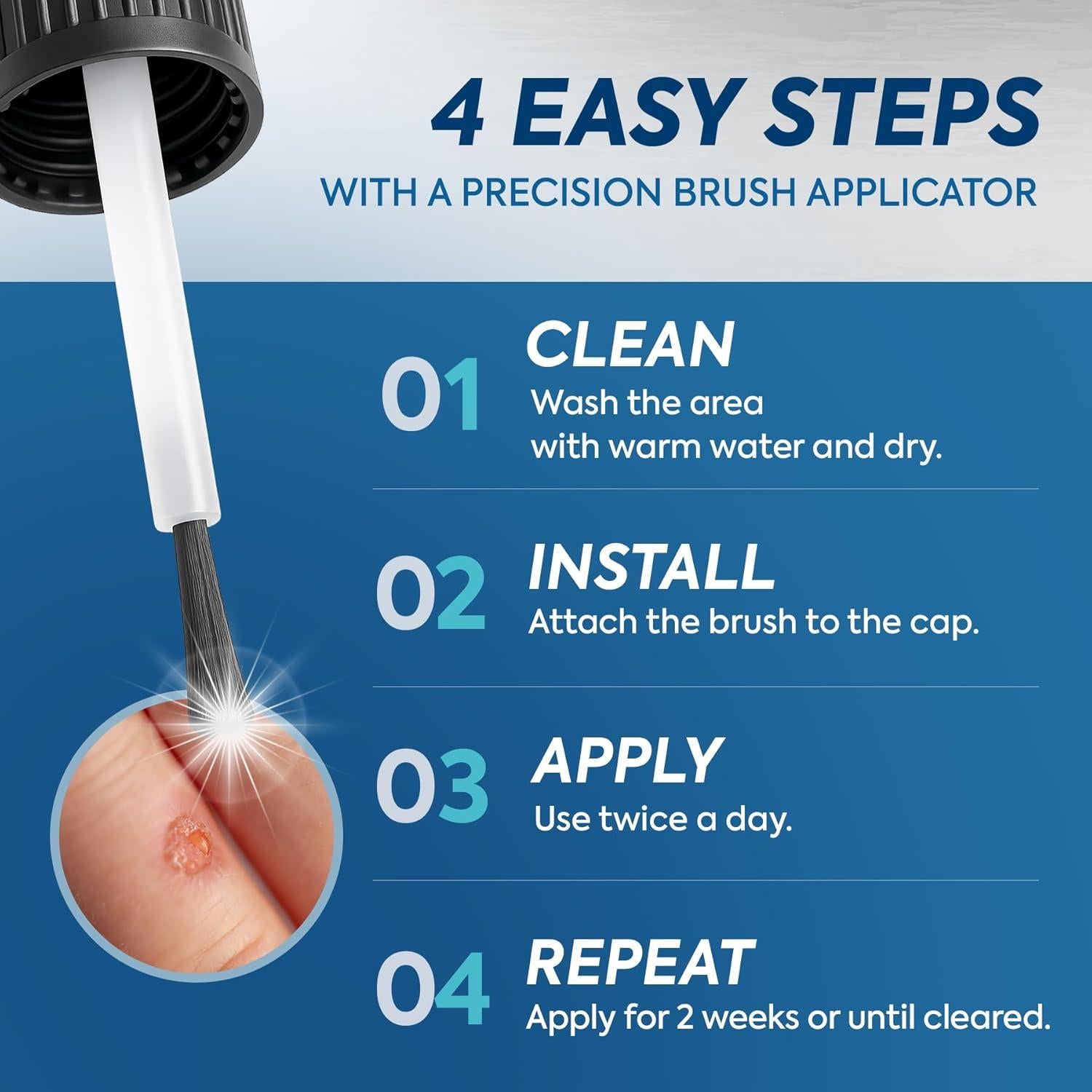 Removedor de Verrugas Plantares Uikeaft 15ml - Ácido Salicílico