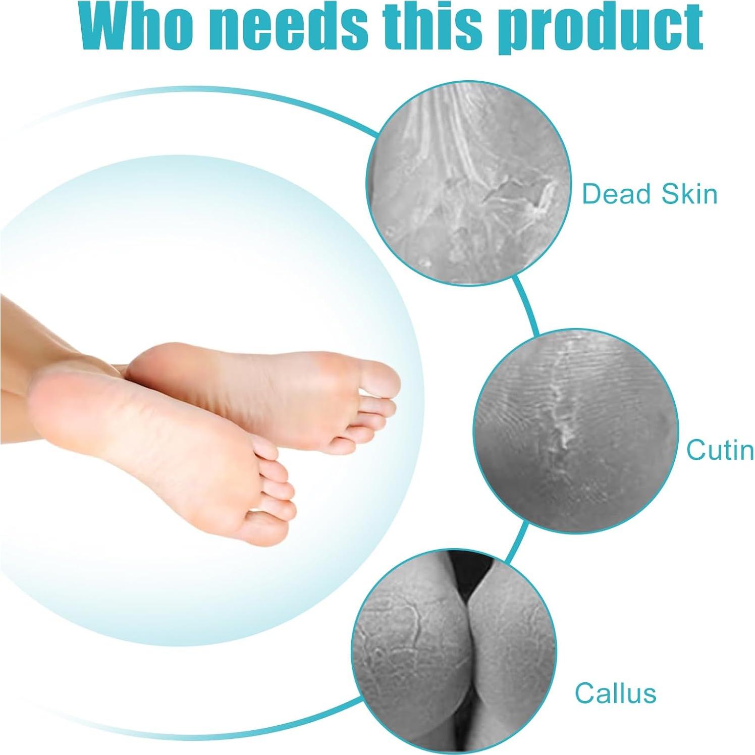 Removedor de Callos para Pies Yclin - 4 en 1 con Lima Gris