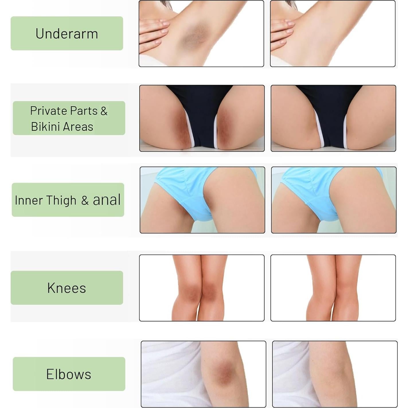 Crema Aclaradora Ceavo 30ml para Áreas Íntimas y Cuerpo