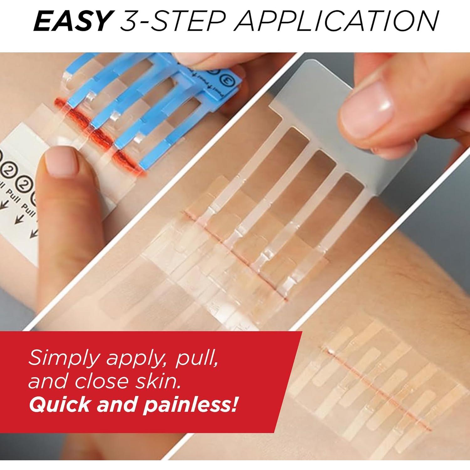 Clozex Cierre de Laceraciones - 2 Cierres Estériles 3,81 cm