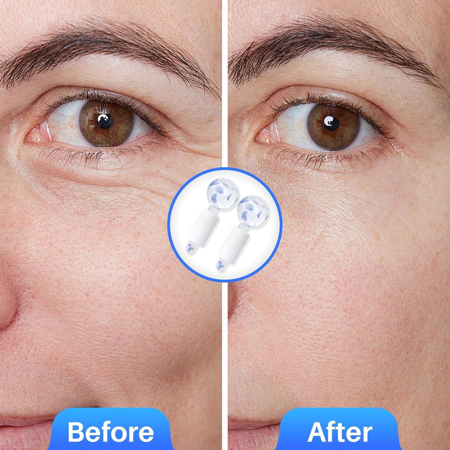 Esferas de Hielo Facial Ylowcoo 2PCS Azul - Masaje Antienvejecimiento