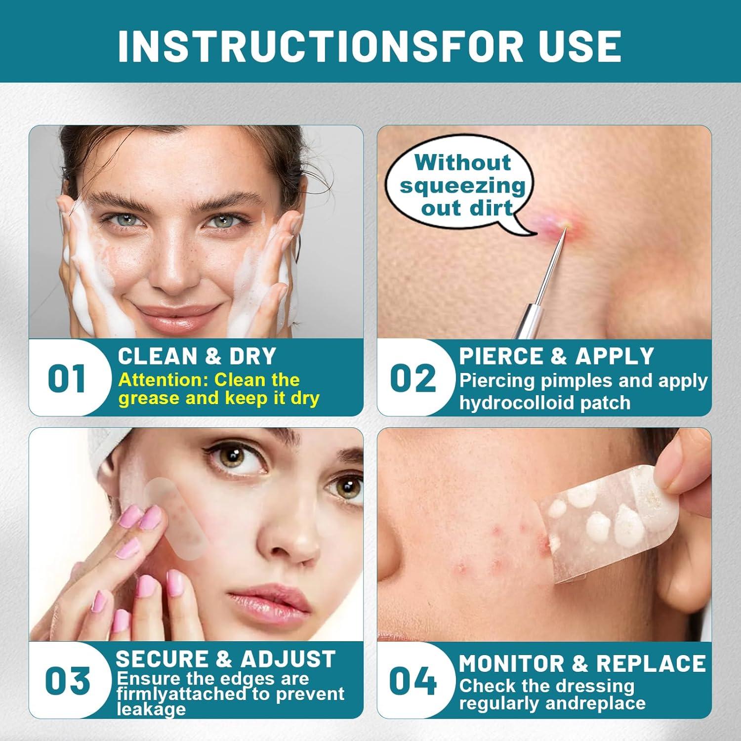 Parches Hidrocoloides para Acné WUYUAN 1.68cm x 19.05cm