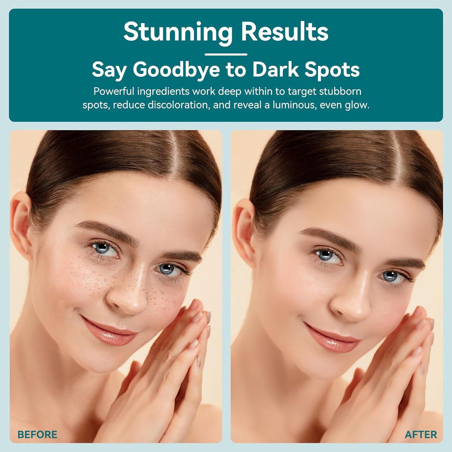 Removedor de Manchas Oscuras UFEEK con Bola de Masaje 360°