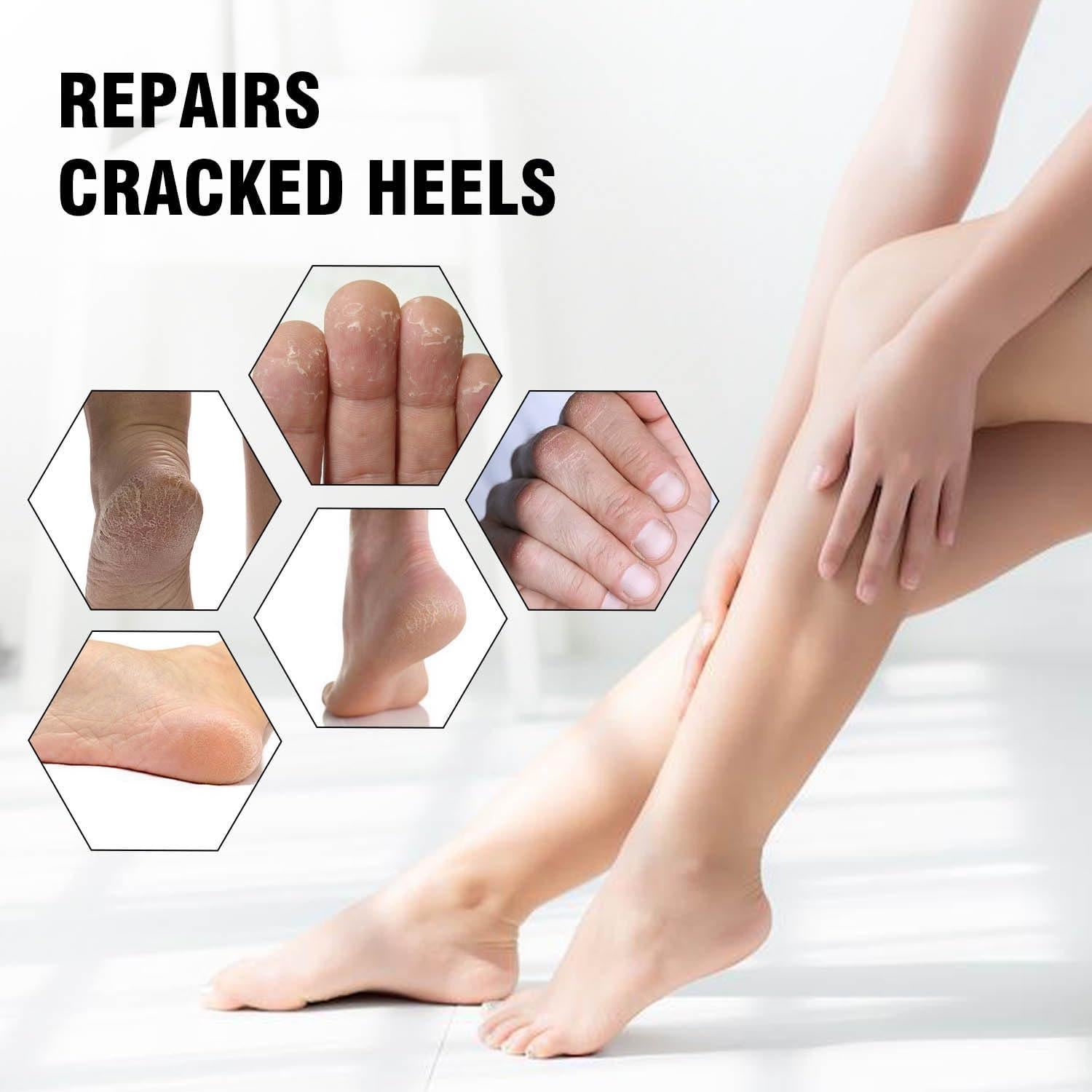 Juego de Calcetines y Guantes Hidratantes HATINXIA Rosa