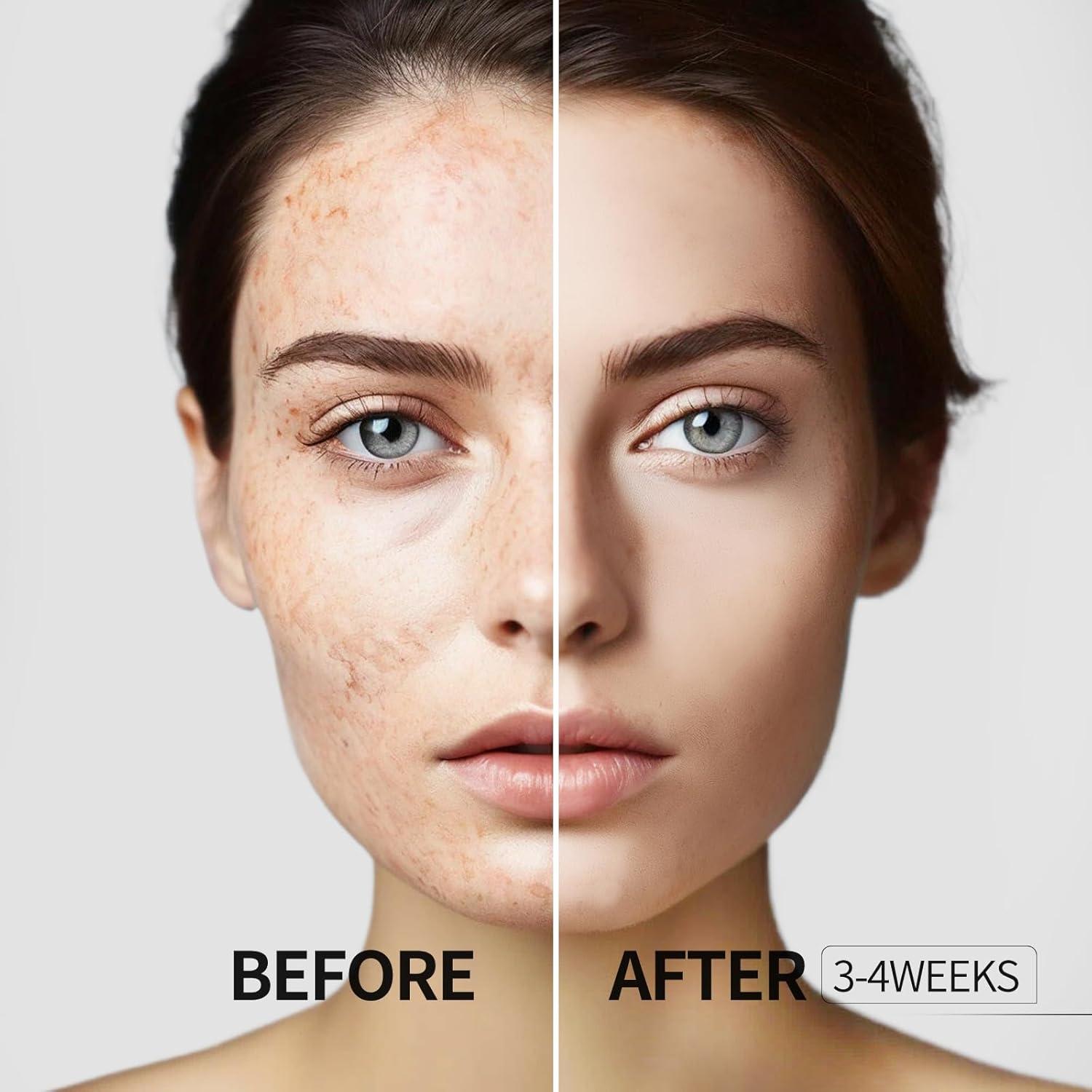 Suero Corrector de Manchas HANYWIL 15 ml con Rodillo