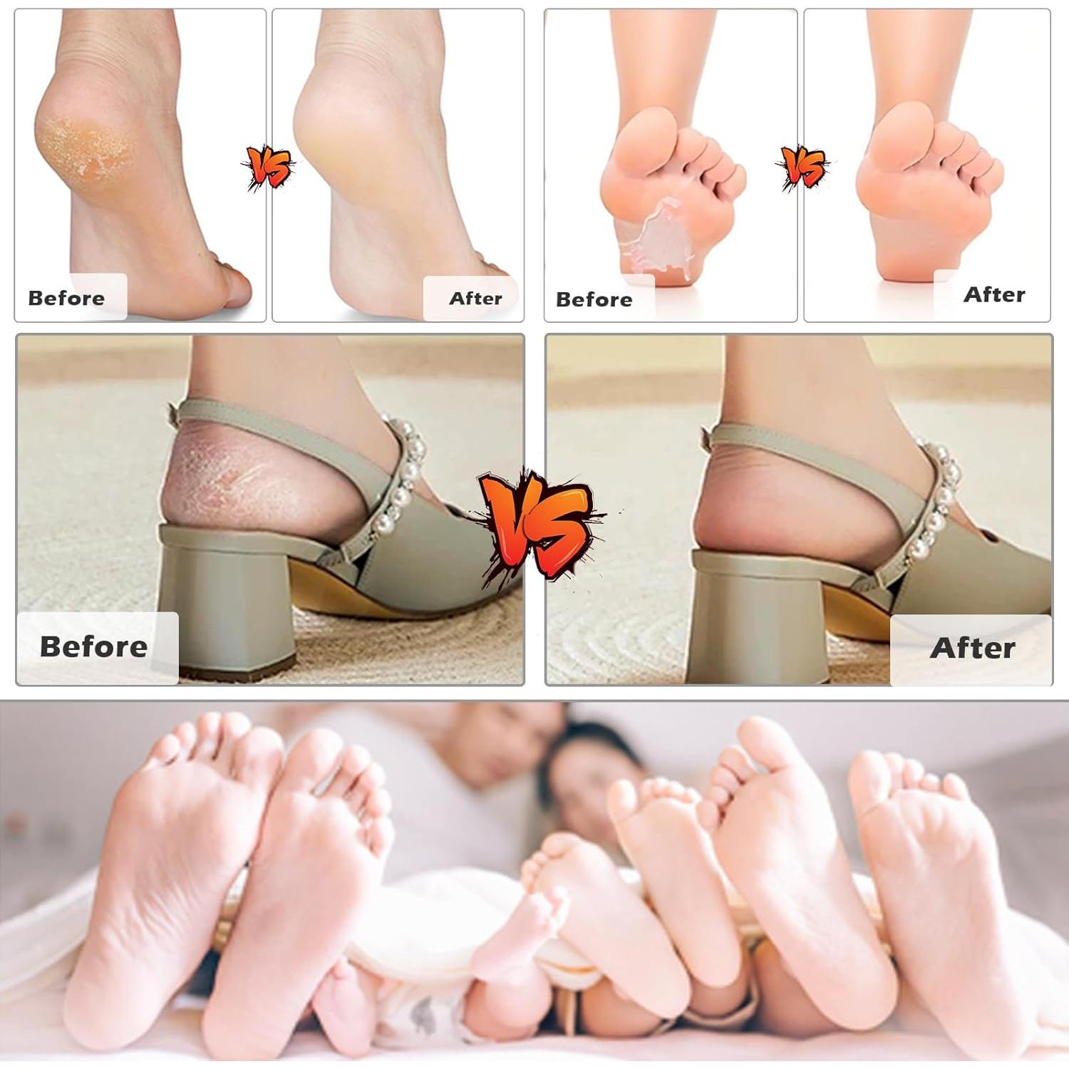 Lima de pies Aenfaiy de acero inoxidable - Removedor de callos