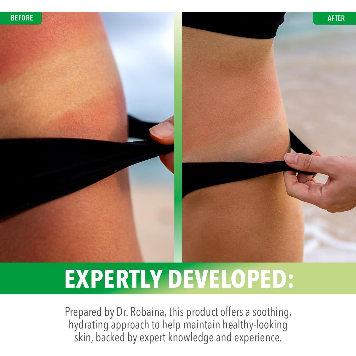 Gel de Aloe Vera Natural Dr. Robaina 340 g - Hidratante y Calmante