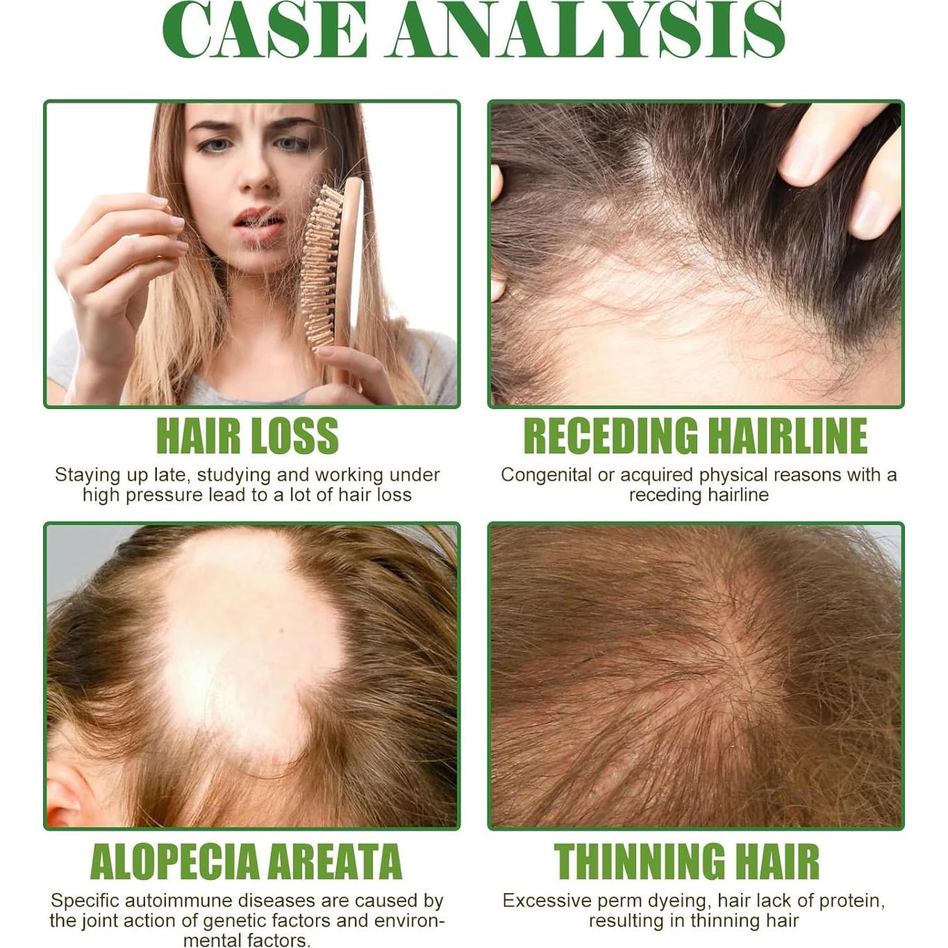 Aceite Esencial de Romero Orgánico 59.87ml - Crecimiento Cabello