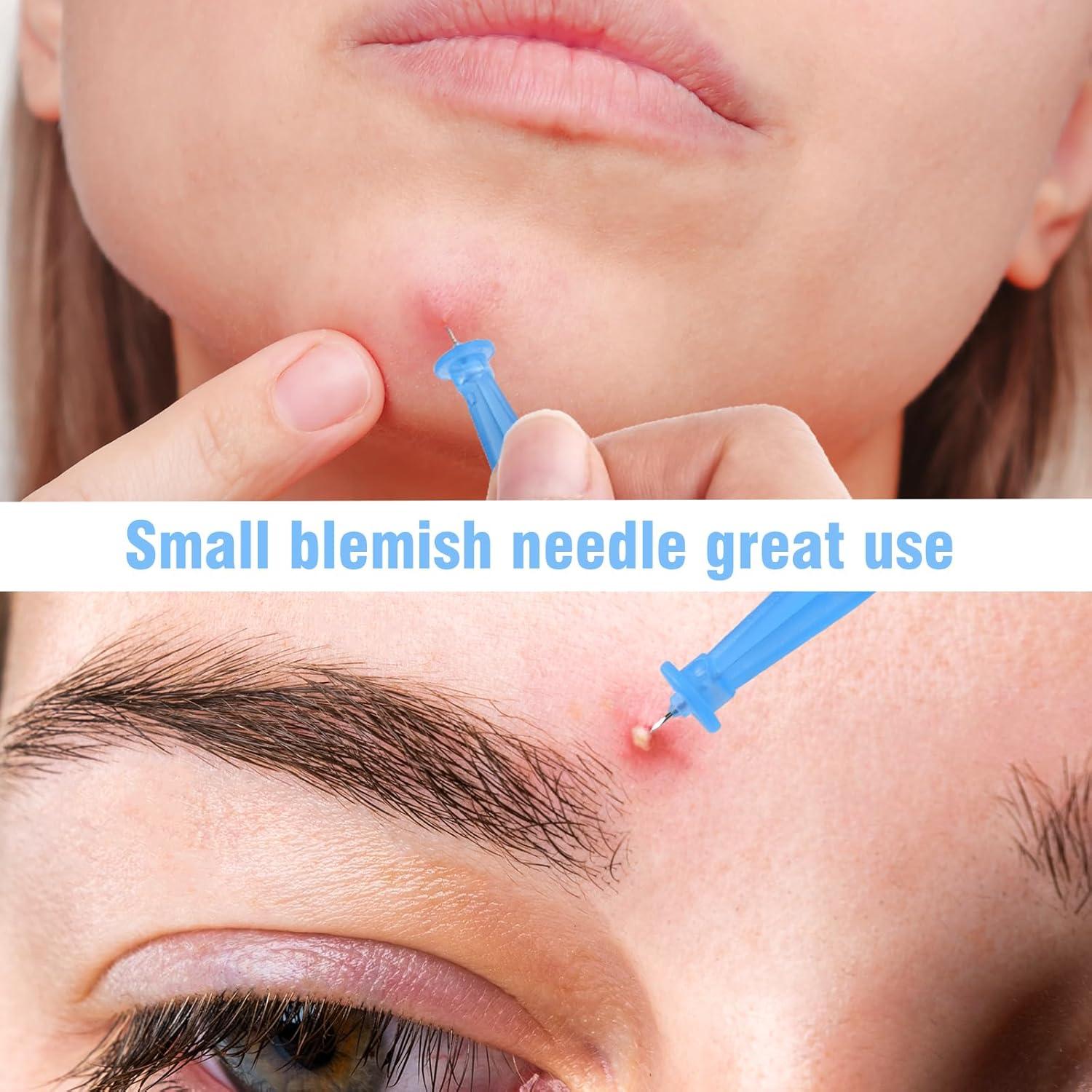 Kit de Remoción de Espinillas AUSLKA - 166 Piezas, Agujas y Parches