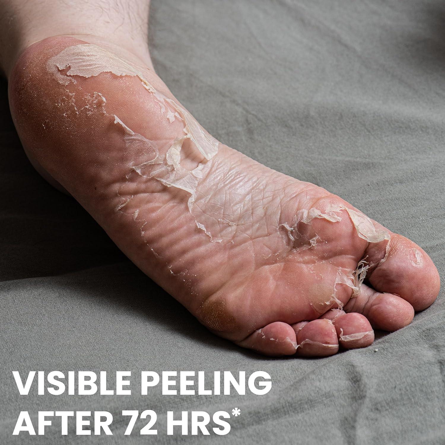 Máscara Exfoliante para Pies Coreana Chamos - Hidratante 1 Par