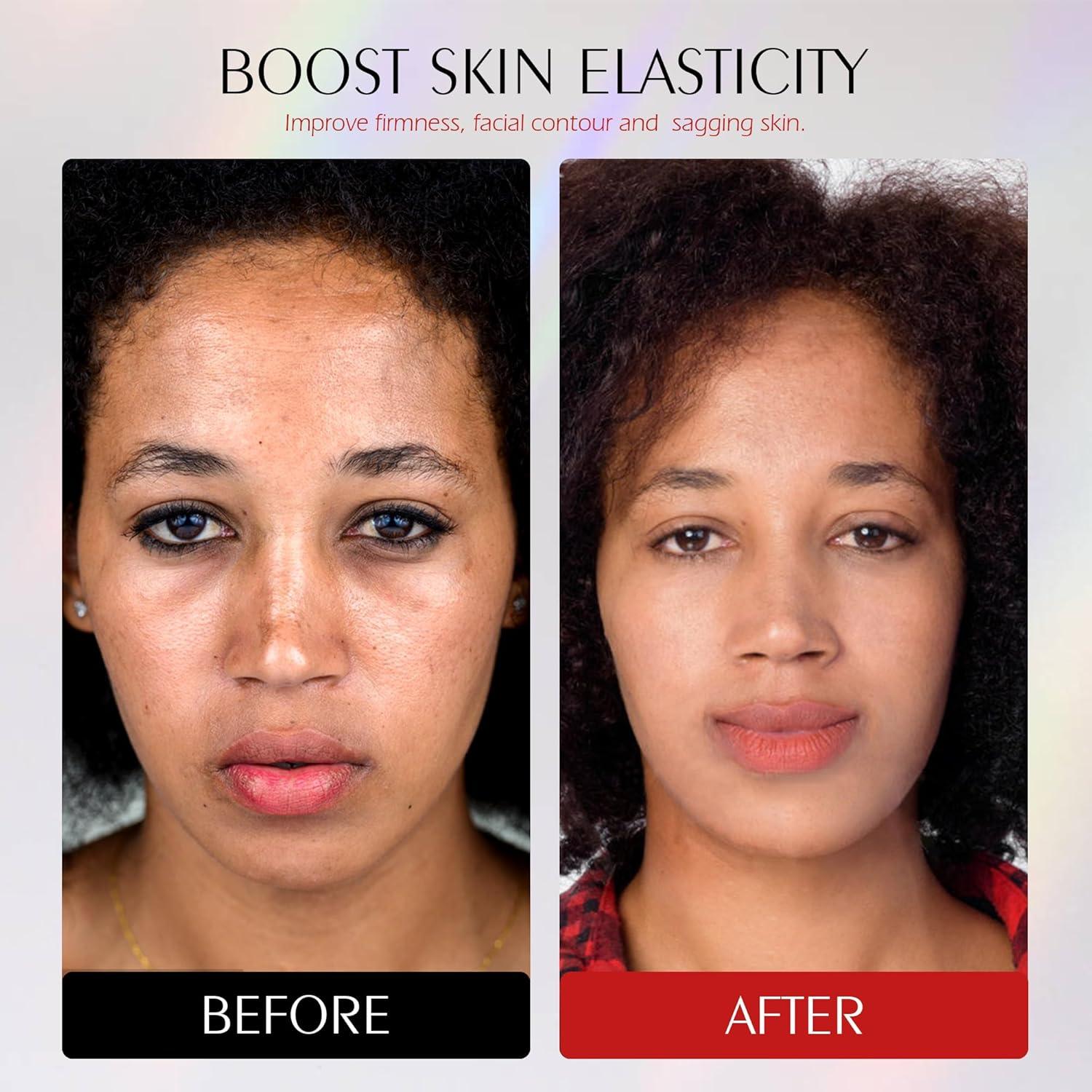 Máscara de Terapia de Luz Roja Photonstar LED 660nm 850nm