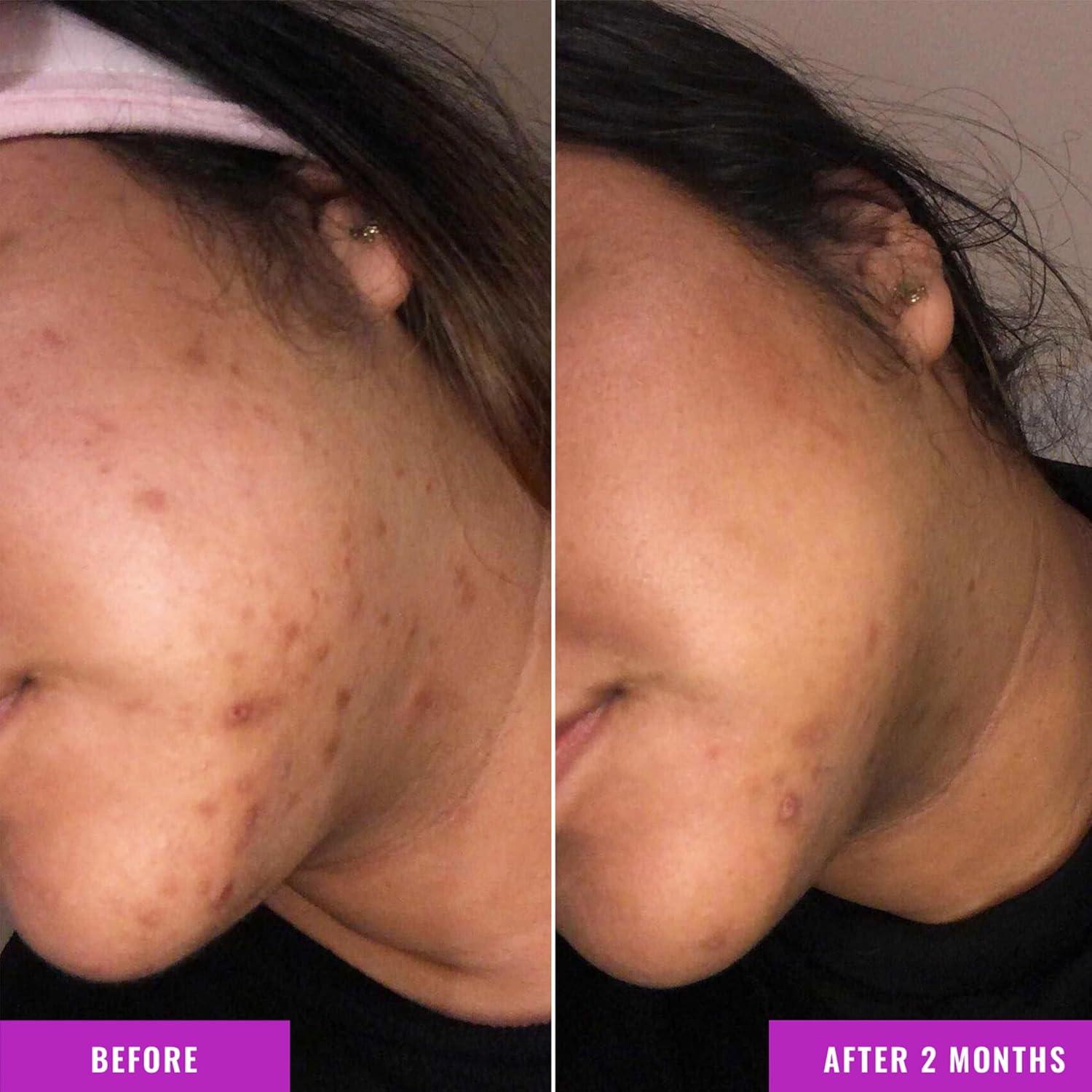 Sérum Corrector de Discoloración Good Molecules 30ml Ácido Tranexámico