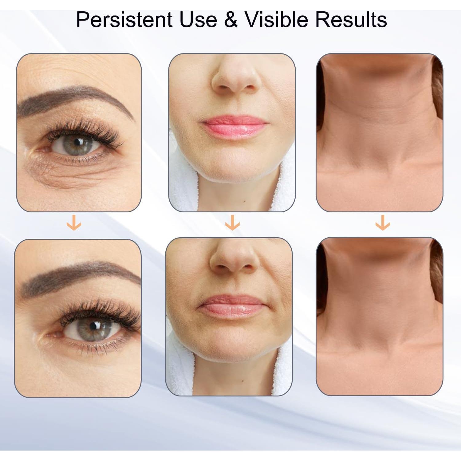 Masajeador Facial Cibqun CC0606 7 Luces LED Portátil