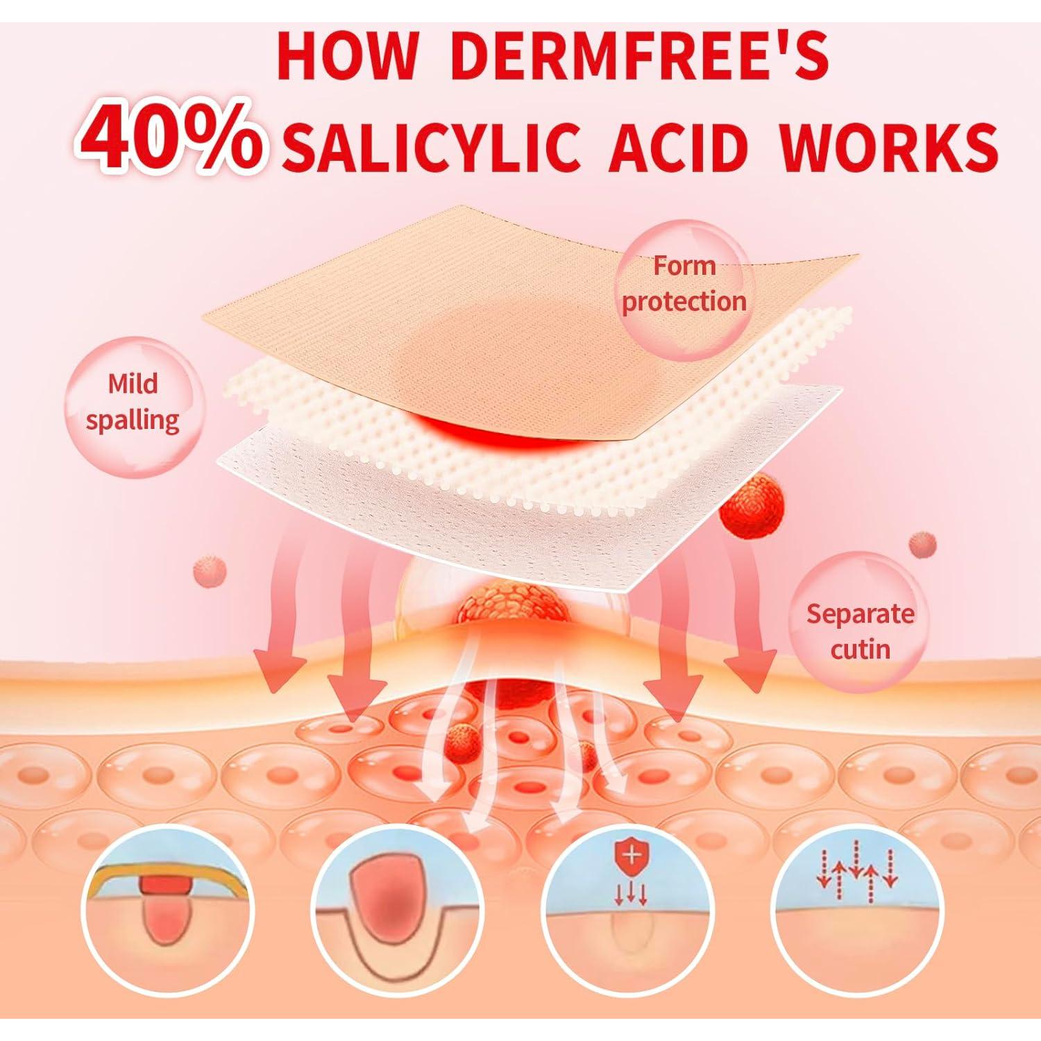 Parche Removedor de Callos Dermfree 42 Piezas 40% Ácido Salicílico