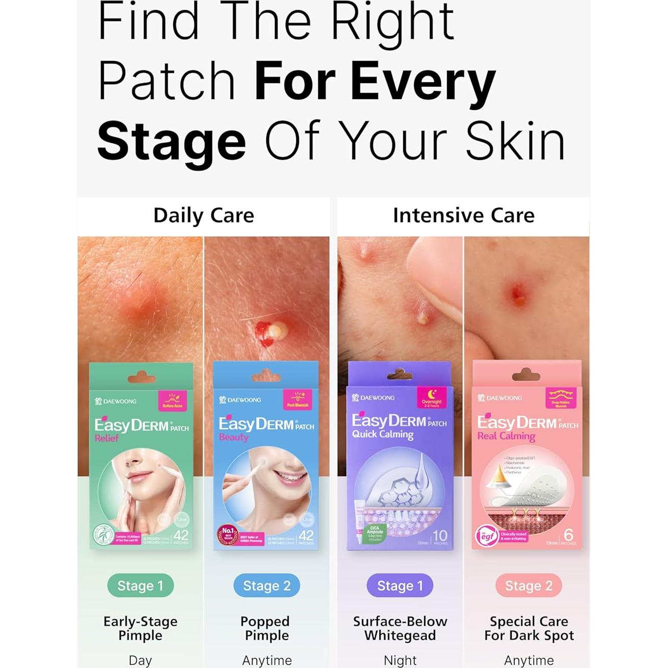 Conjunto de Parches para Granos Easyderm Daewoong 4 Tipos