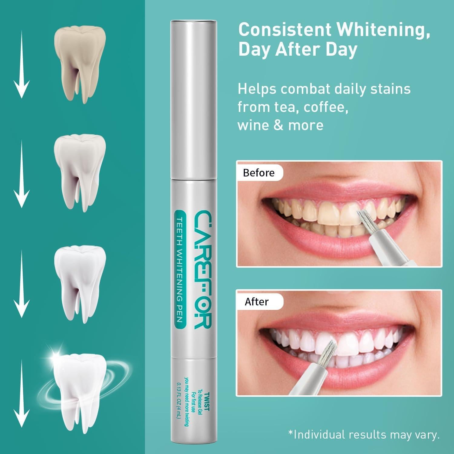 Bolígrafo Blanqueador de Dientes Onuge 4ml Kit Viaje