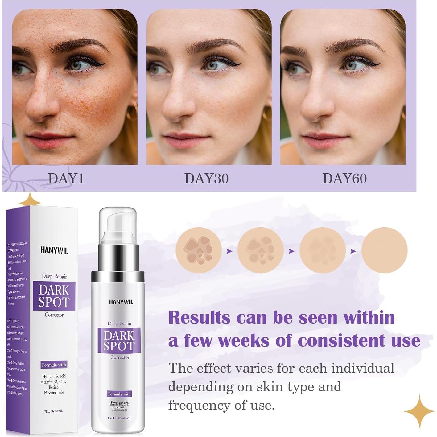 Crema Correctora de Manchas Oscuras HANYWIL 50 ml