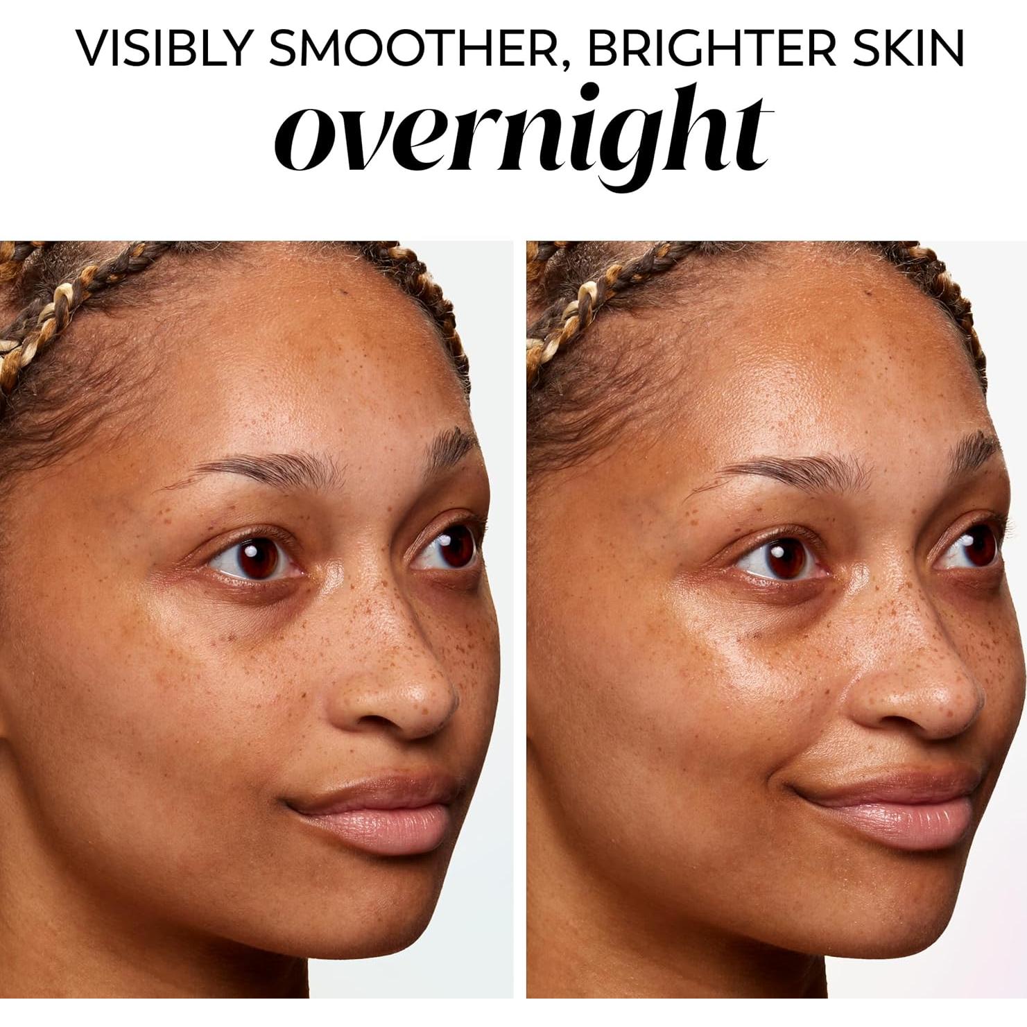 Hidratante Facial Olay Retinol 56.7g - Antienvejecimiento Nocturno