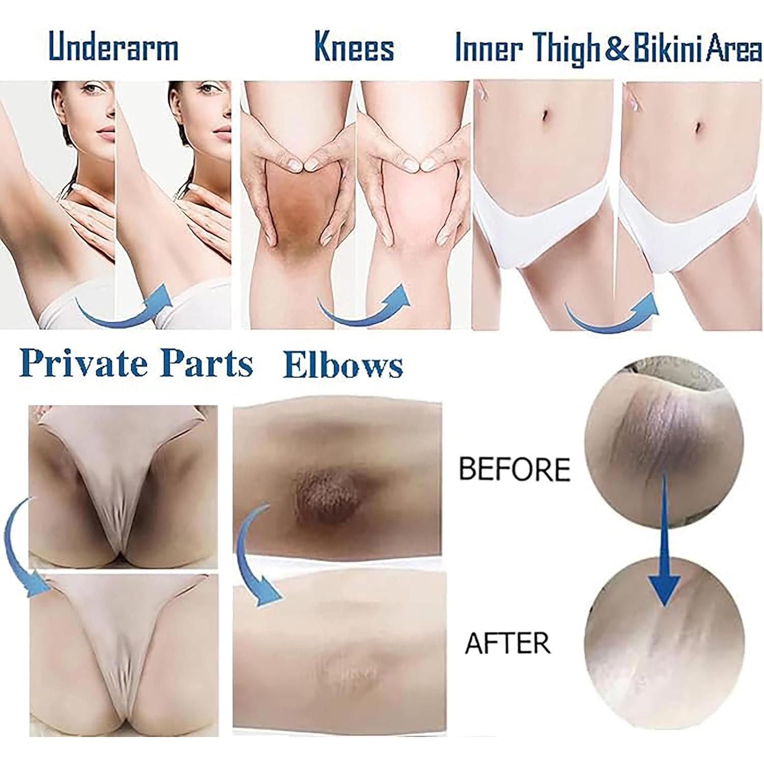 Crema Aclaradora de Piel Ceavo 30 ml para Áreas Íntimas