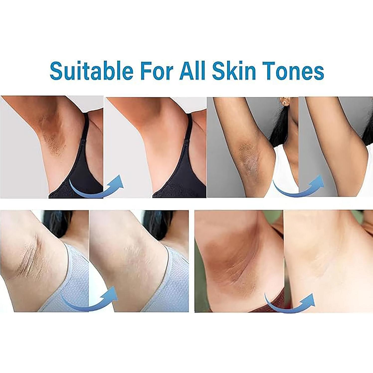 Crema Aclaradora de Piel Ceavo 30 ml para Áreas Íntimas