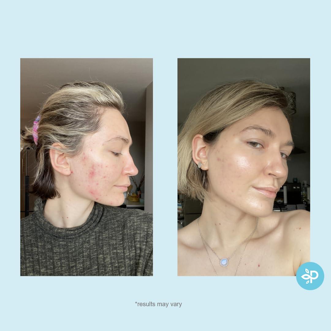 Pads de Peeling Hydro-Glo Perfect Image 10% Fuerza 189g