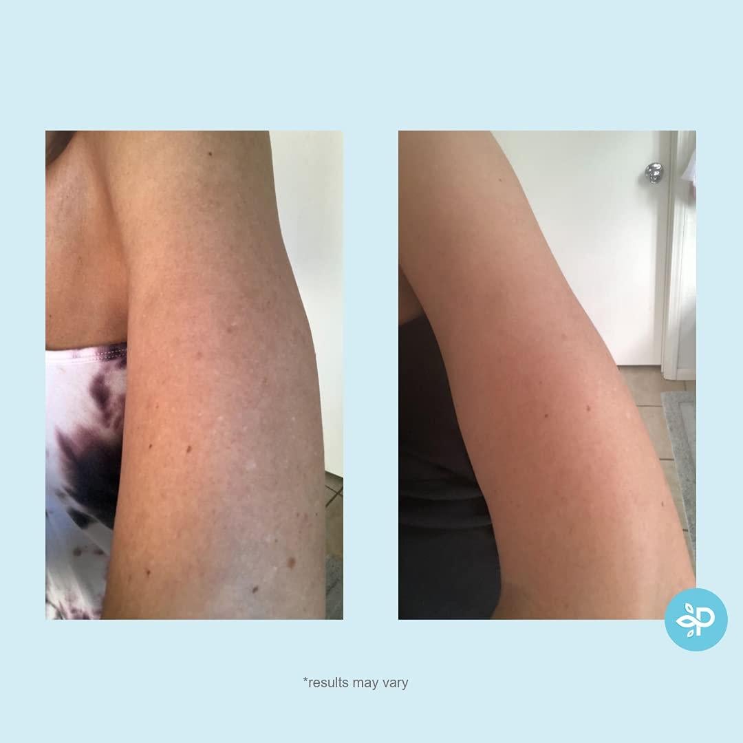 Pads de Peeling Hydro-Glo Perfect Image 10% Fuerza 189g