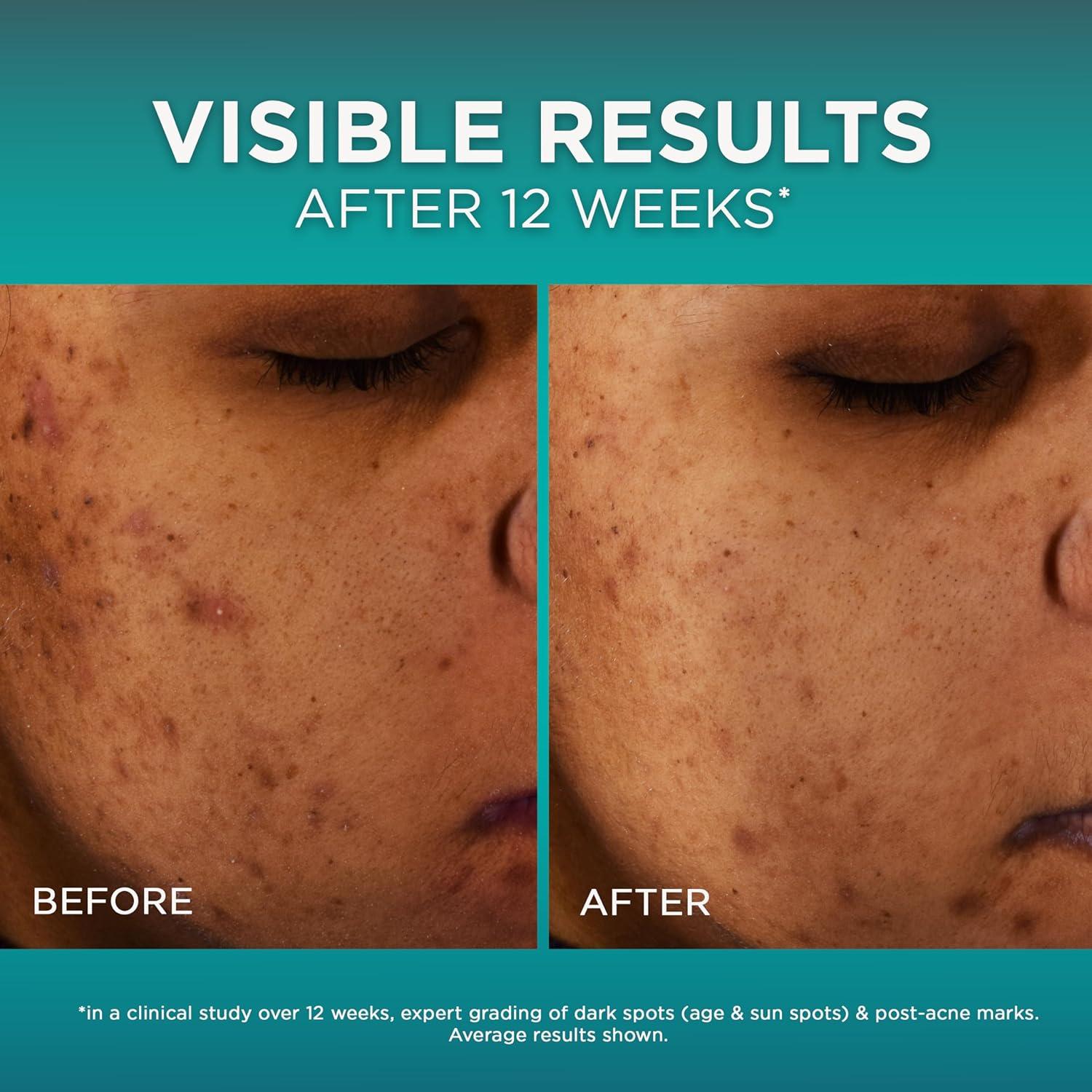 Suero para Manchas Oscuras L'Oréal Paris Bright Reveal 12%