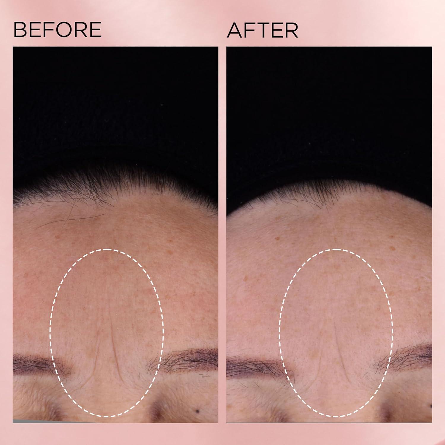 Cápsulas de Suero Renovador Elizabeth Arden 30 Unidades