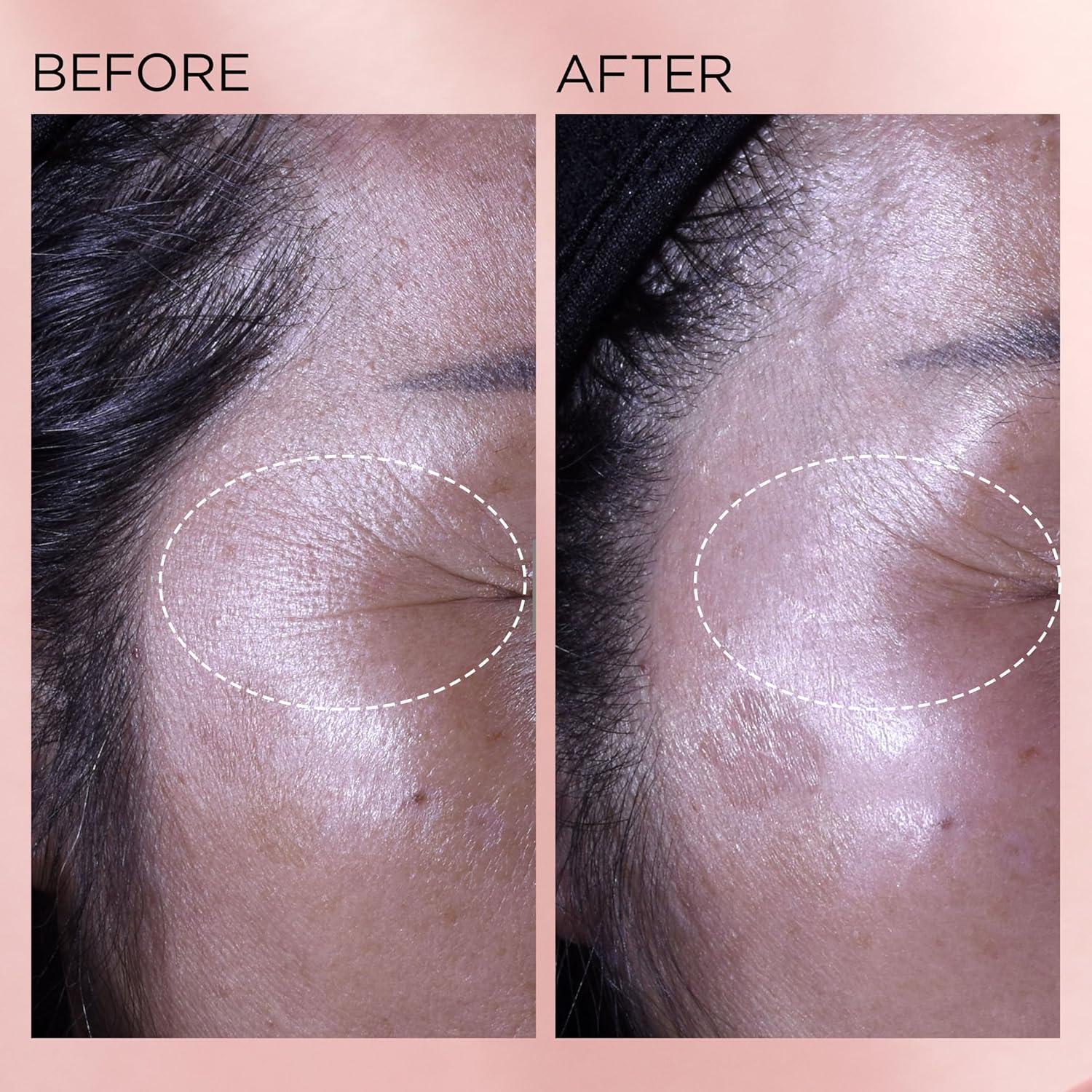 Cápsulas de Suero Renovador Elizabeth Arden 30 Unidades