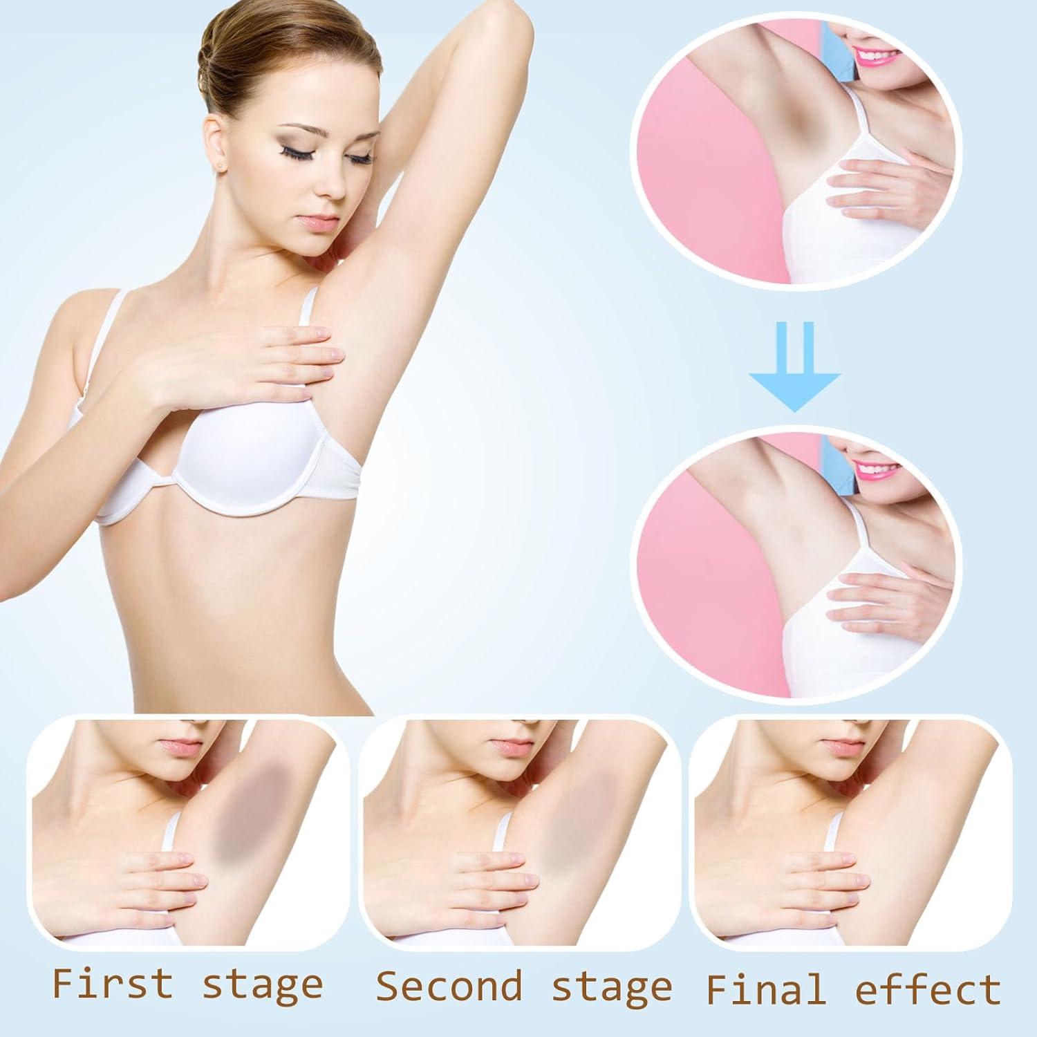 Crema Blanqueadora de Piel Niacinamida 51g - Aclaradora Axilas