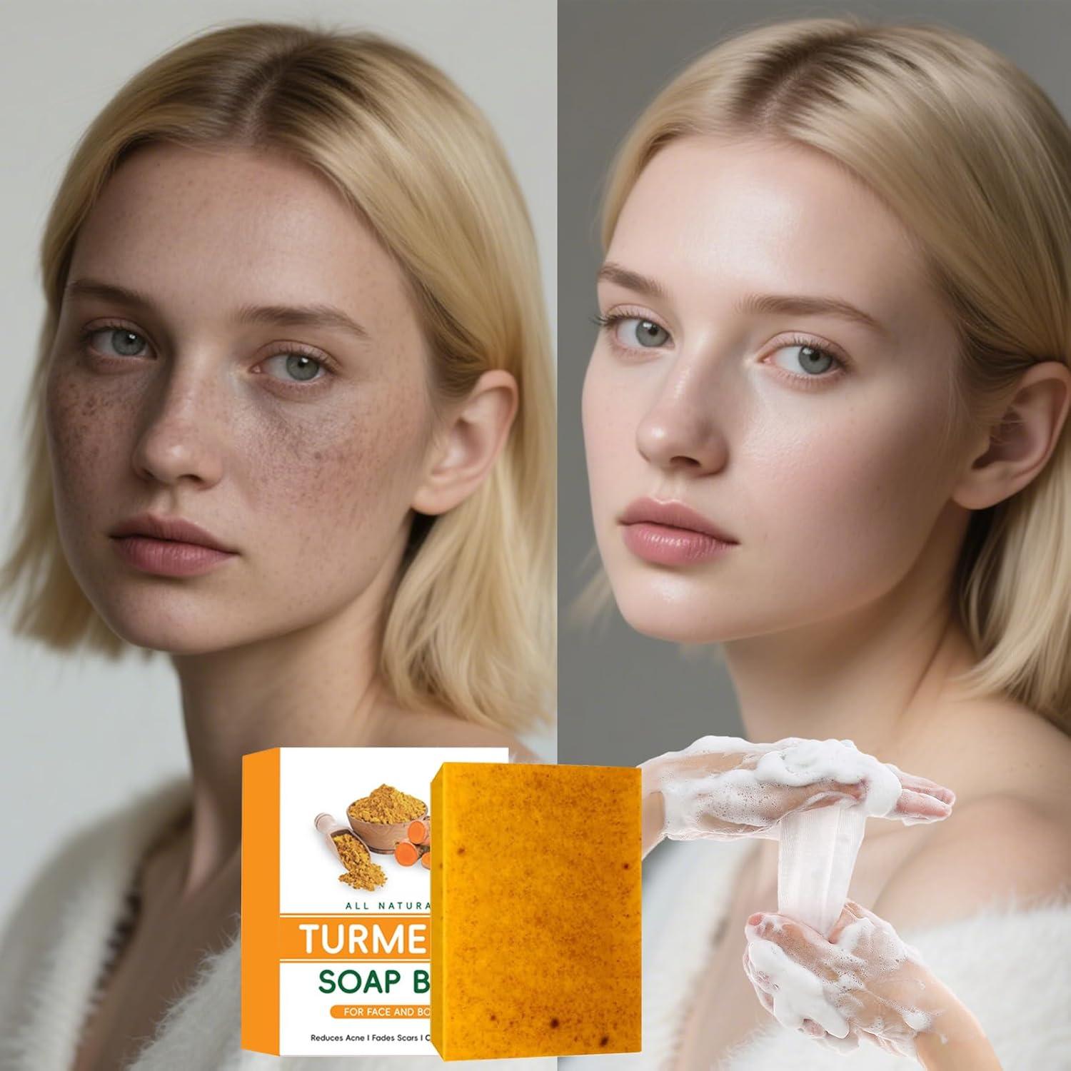 Jabón de Cúrcuma y Limón Kojic FITactic - 3 Piezas 100g