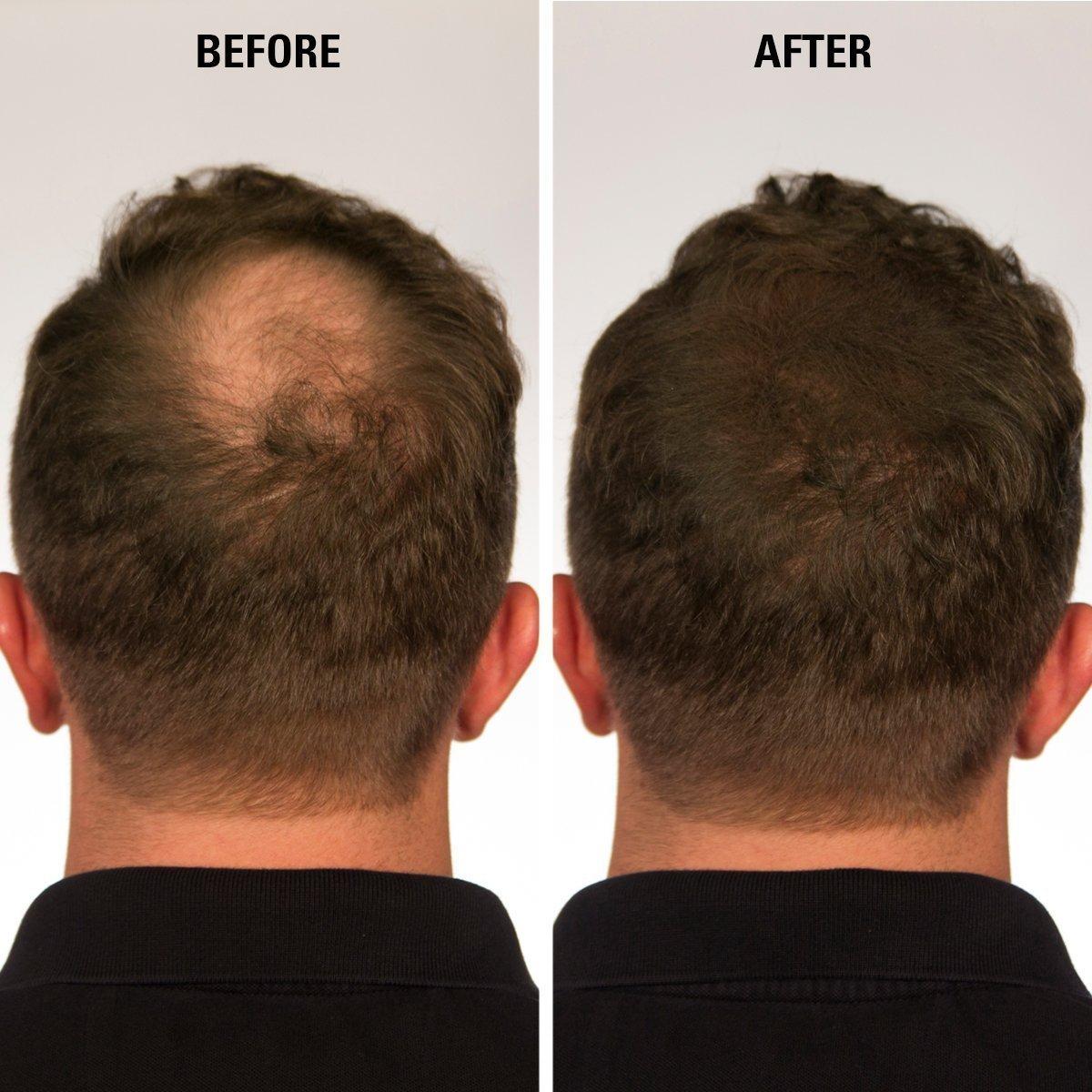 Fibras para Cabello ECLIPSE Castaño 15g Indetectables