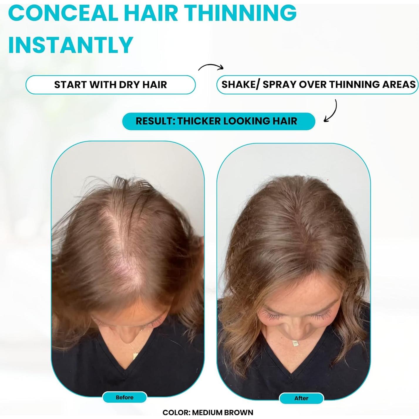 Paquete Fibra para Cabello SureThik - 15g + Spray 90ml