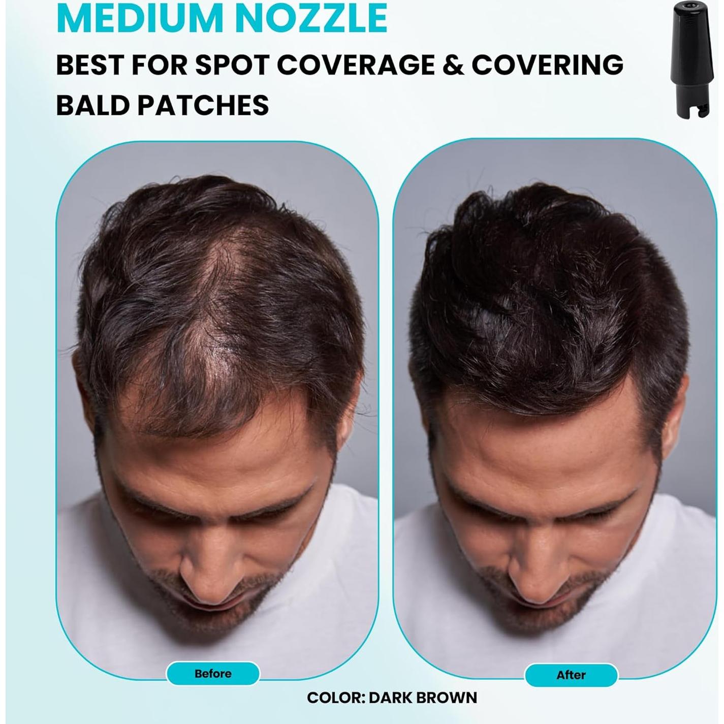 Paquete Fibra para Cabello SureThik - 15g + Spray 90ml