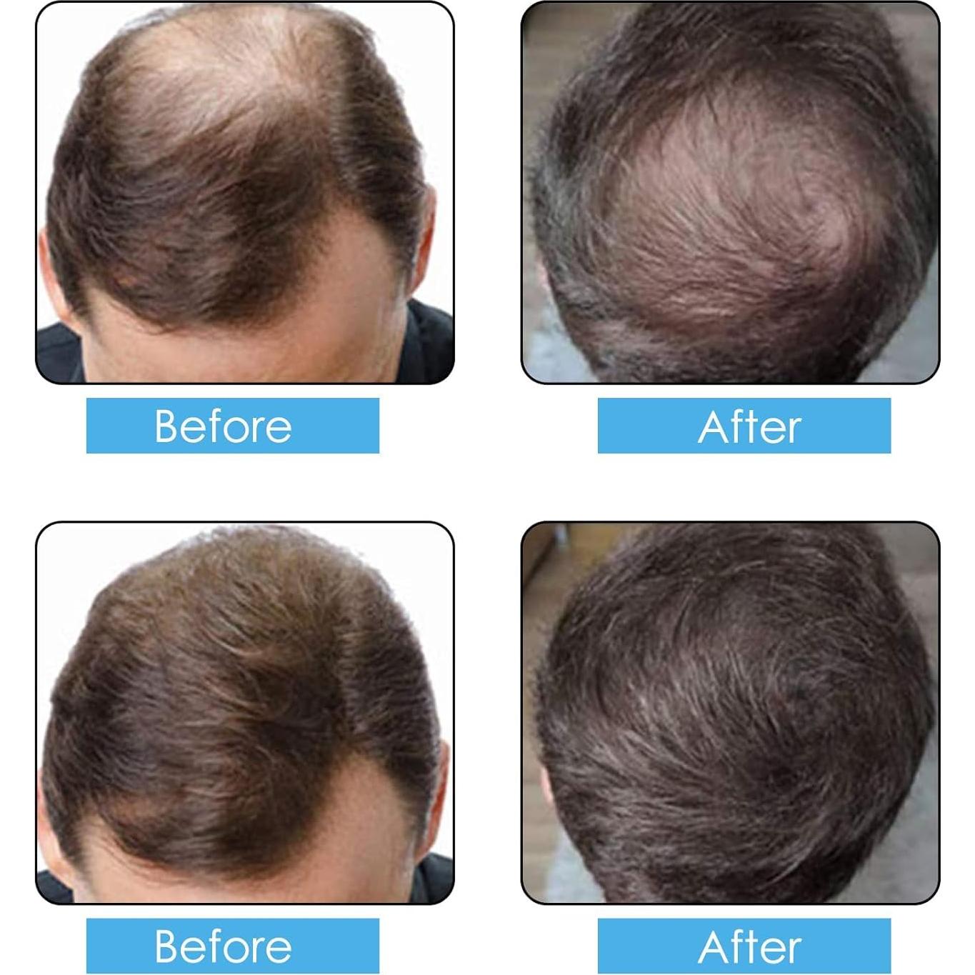 Spray de Fibras para Cabello Aliver 100g Marrón Medio