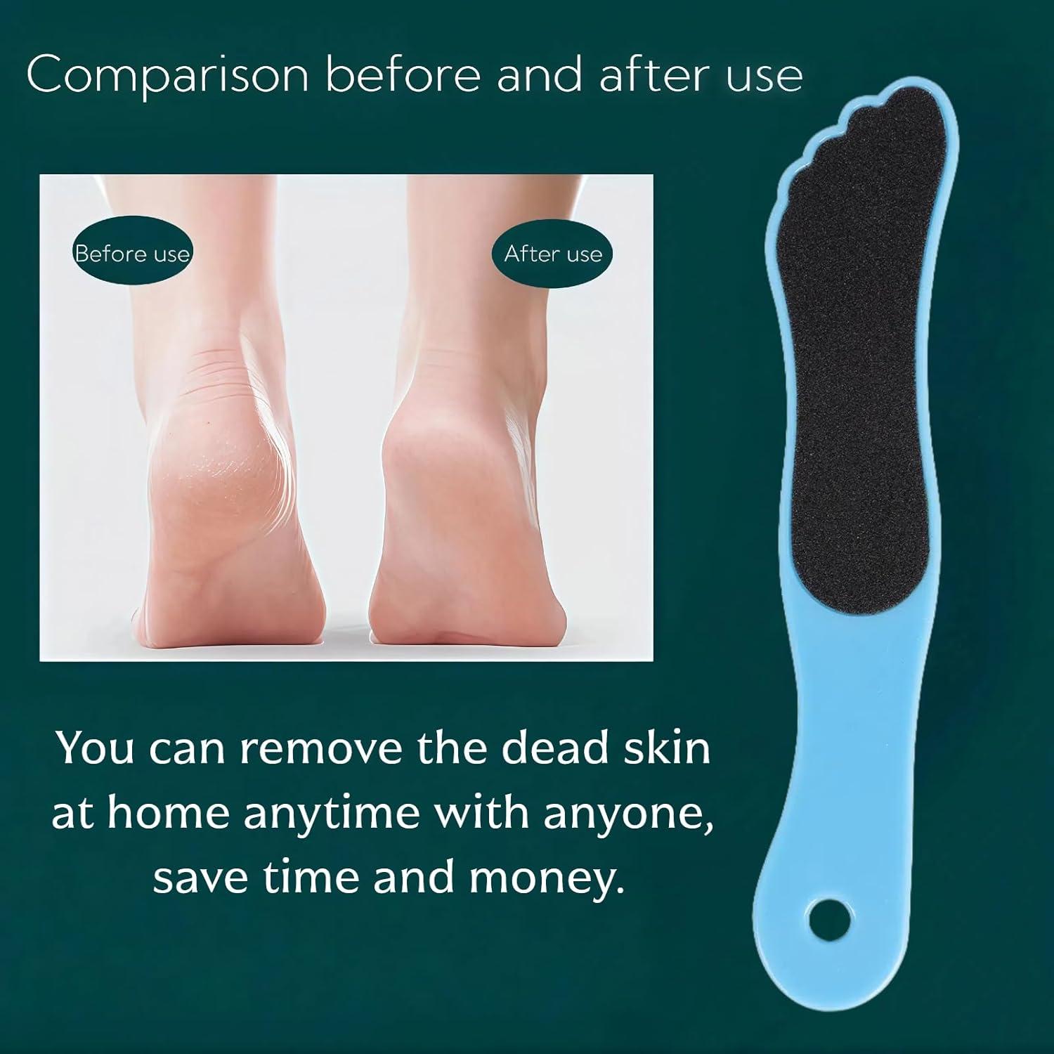 Paquete de 10 limas para pies Agirlvct, removedor de callos