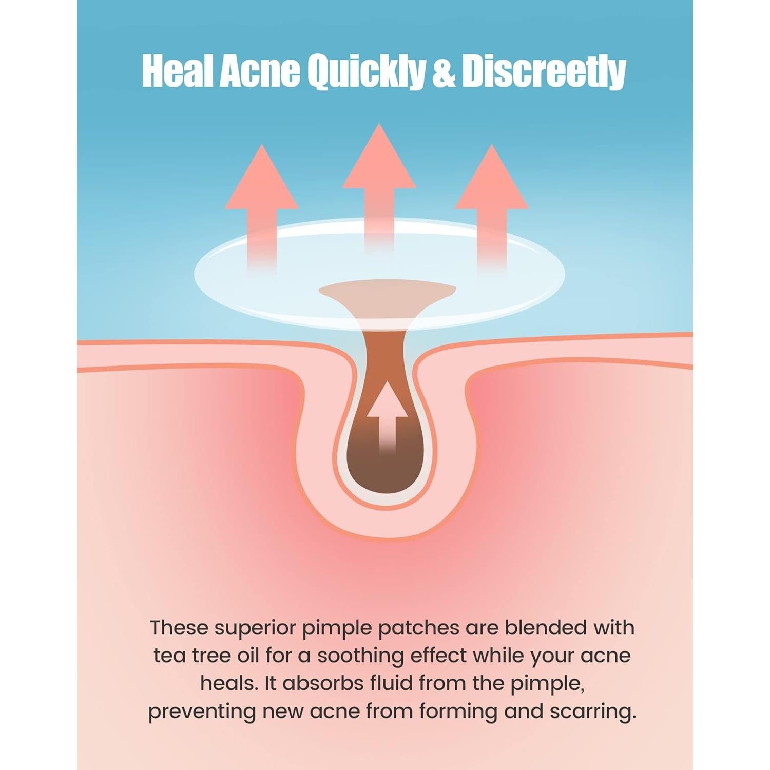 Parche para Granos Jefusst 210 Cuentas Hidrocoloide Vegano