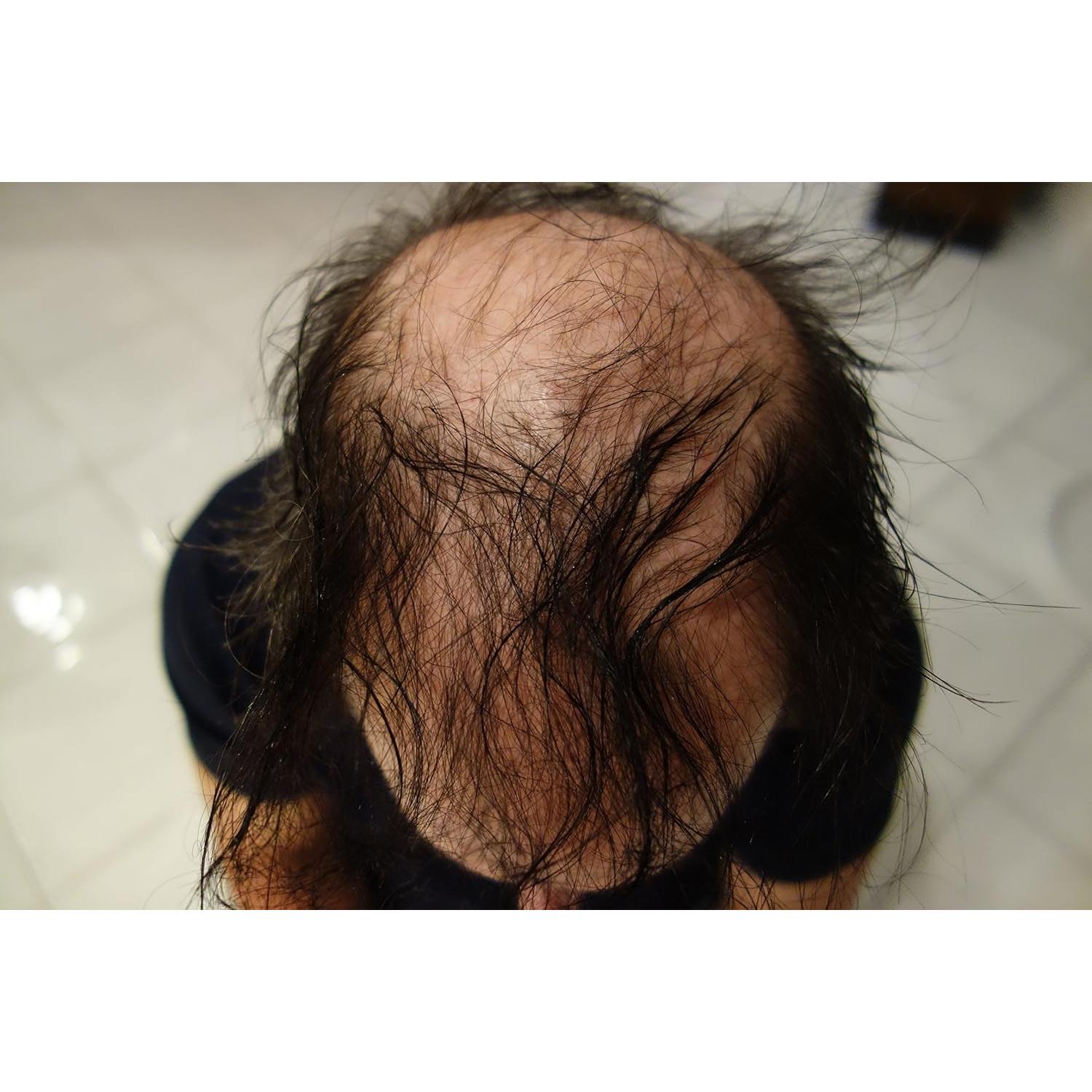 Relleno de Fibra para Cabello Finalmente Hair 100g Marrón