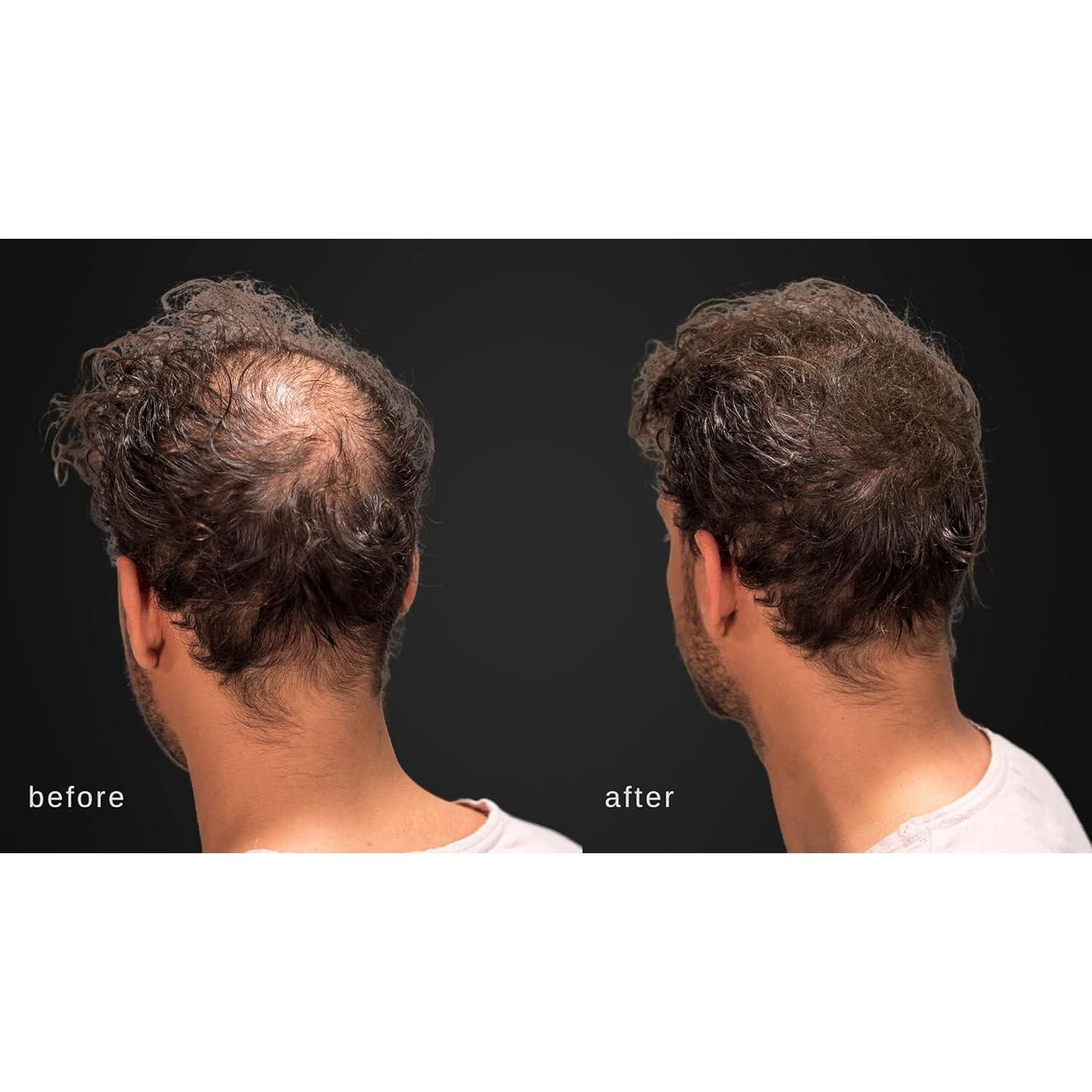 Fibras Capilares Maxx Pro-Series con Keratina 25g Marrón Oscuro