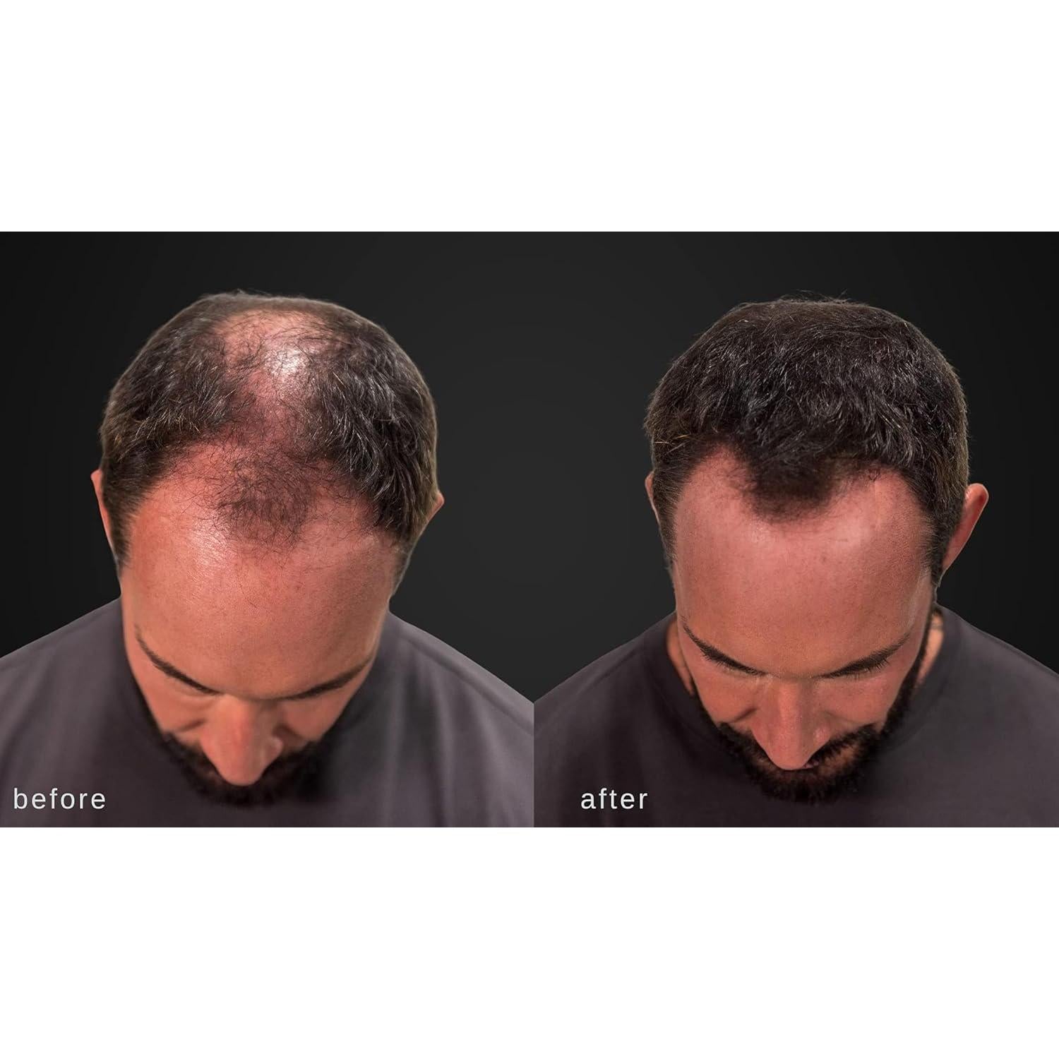 Fibras Engrosadoras para Cabello LUXE 25g Color Negro